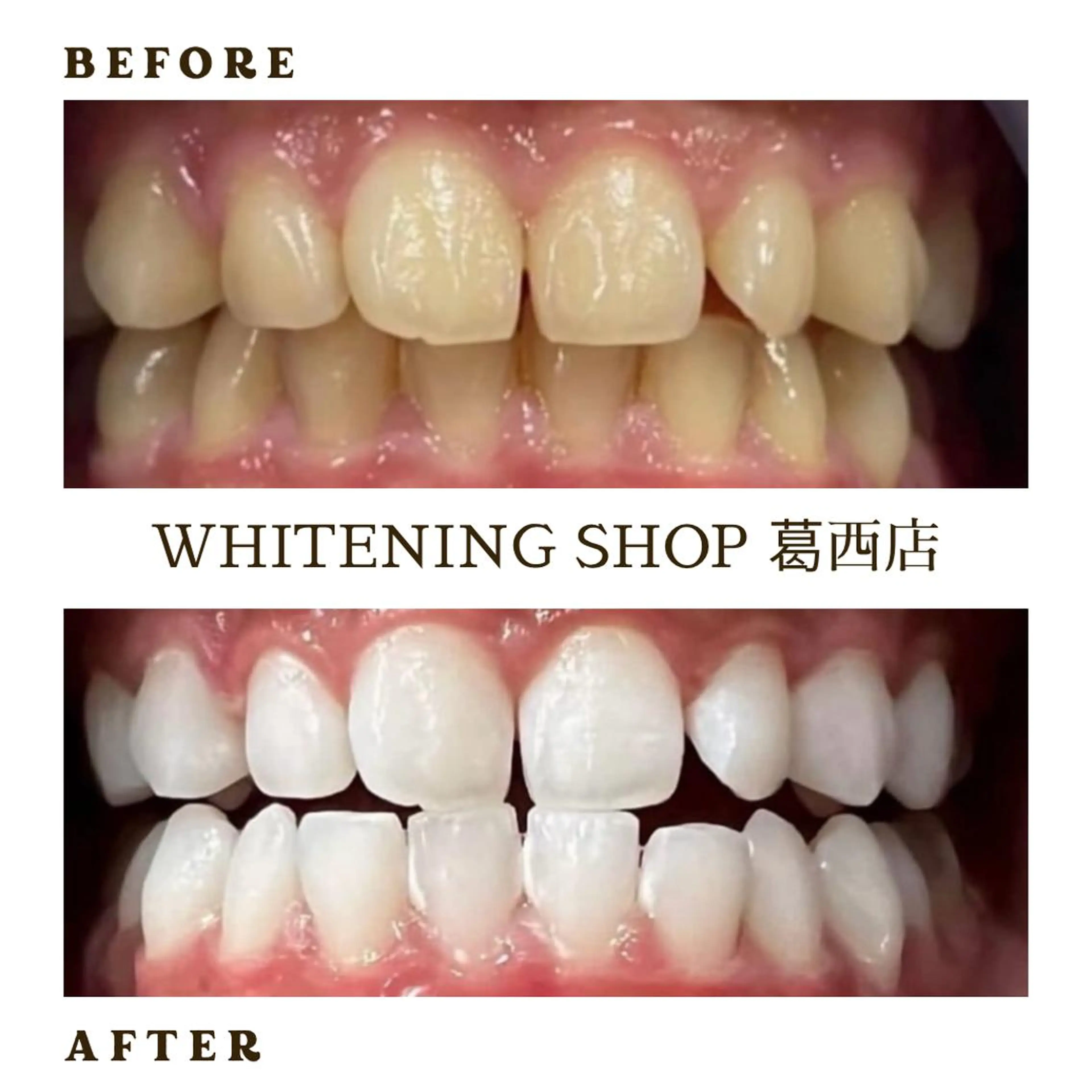 メンズ その他 ホワイトニング ショップ葛西店のその他イメージ