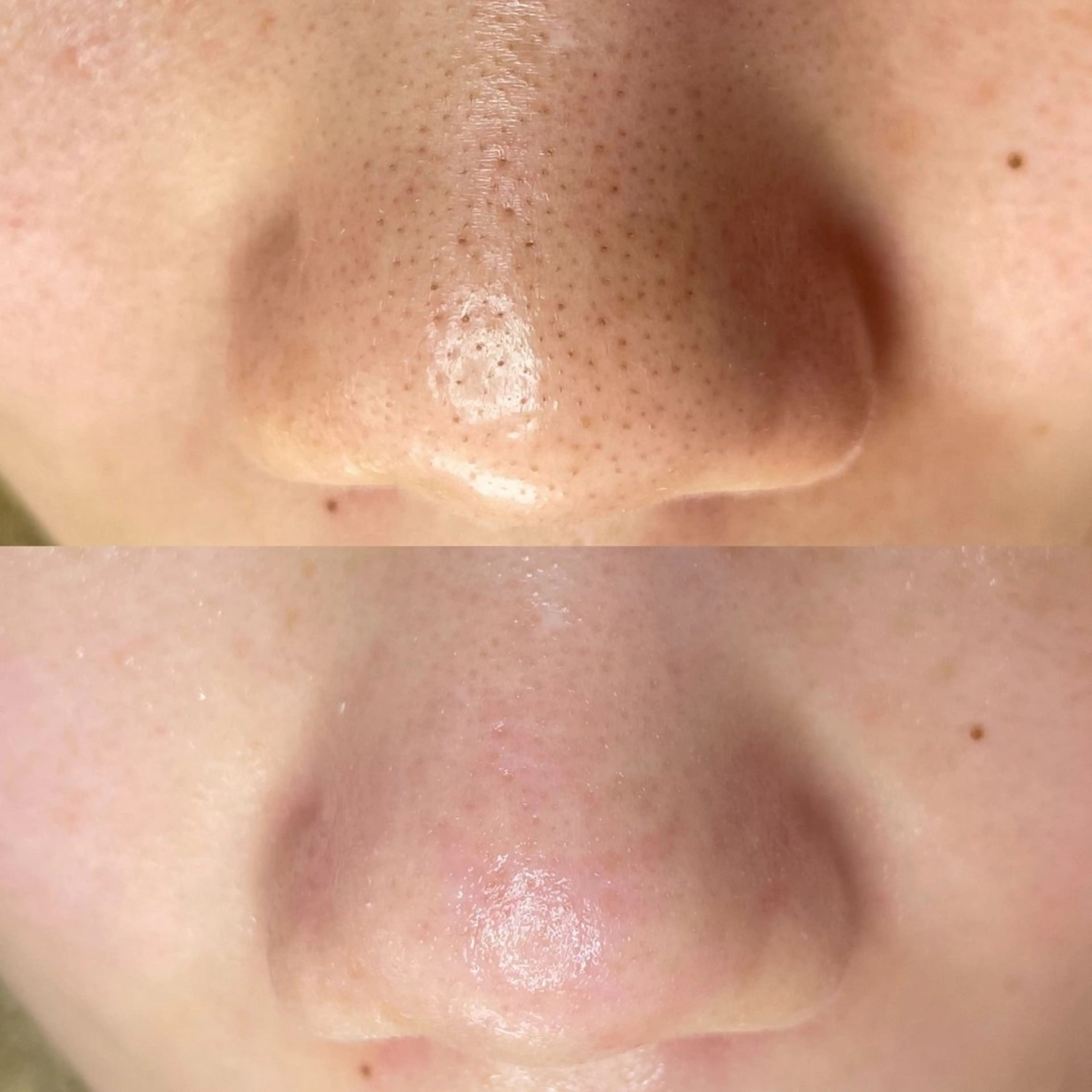 毛穴専門店MeMe.八千代店所属・毛穴・頭皮 専門店💪のその他イメージ