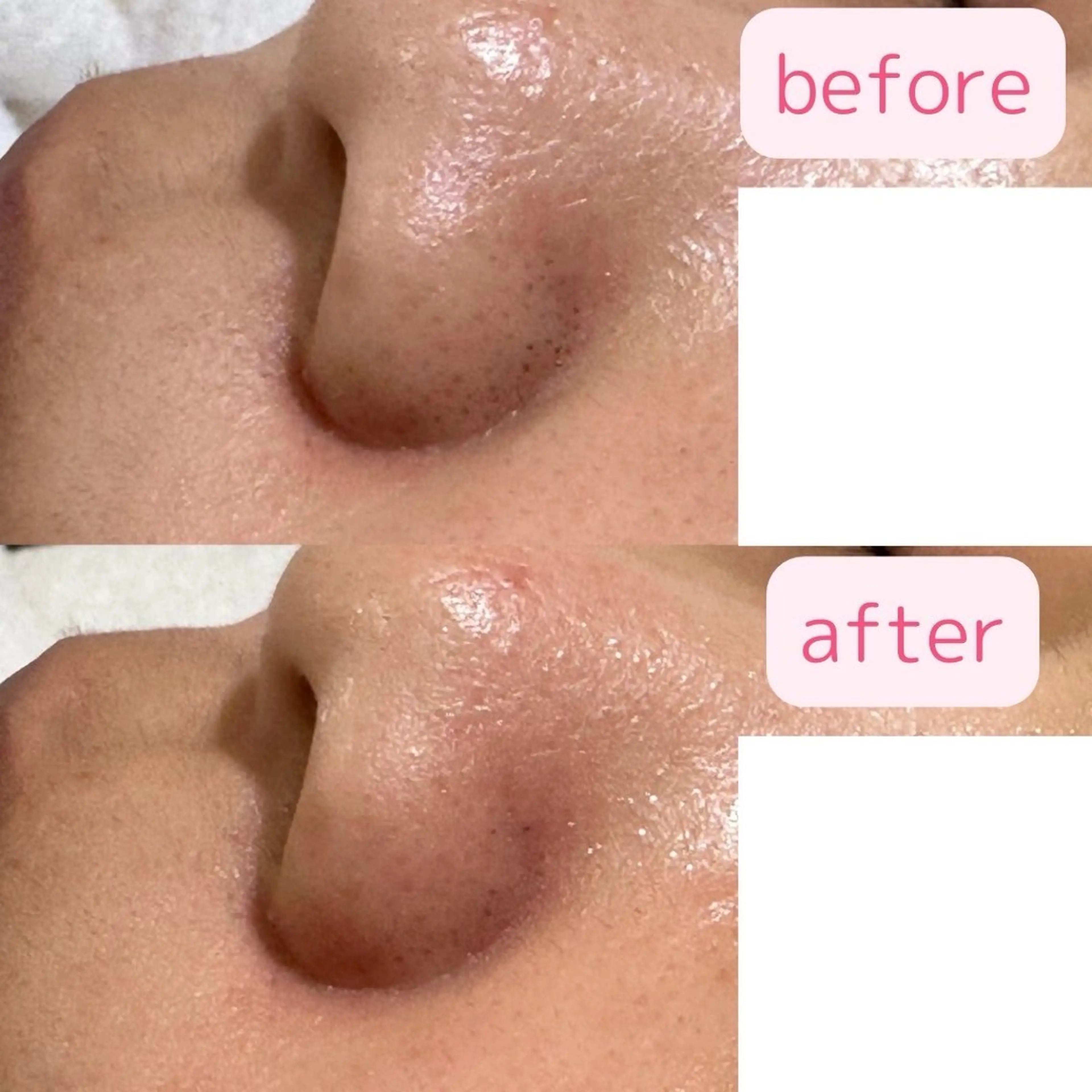 肌質改善美容サロン ému 用賀のエステ・リラクイメージ