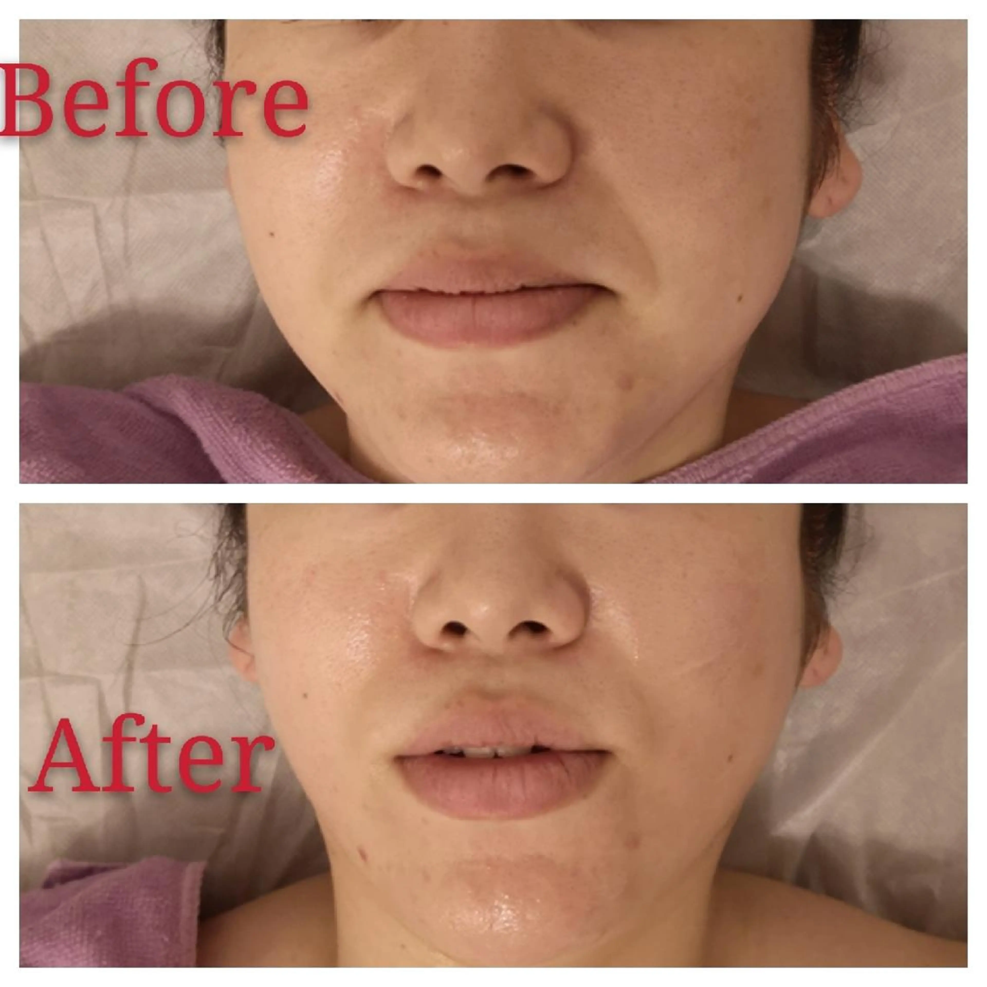 🅖🅤🅩🅔🅛 salonのエステ・リラクイメージ