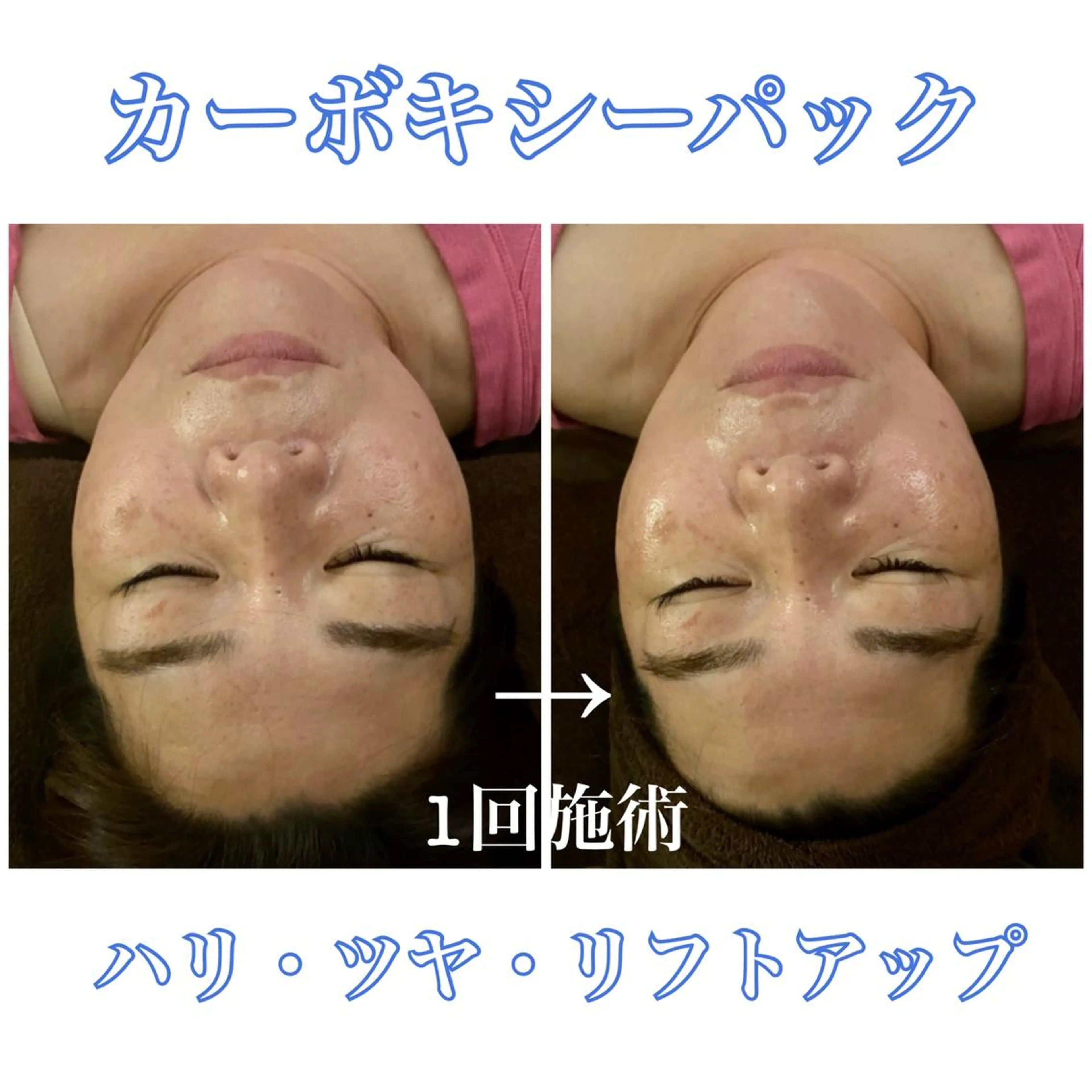 美容鍼灸サロン YOSHINOのエステ・リラクイメージ