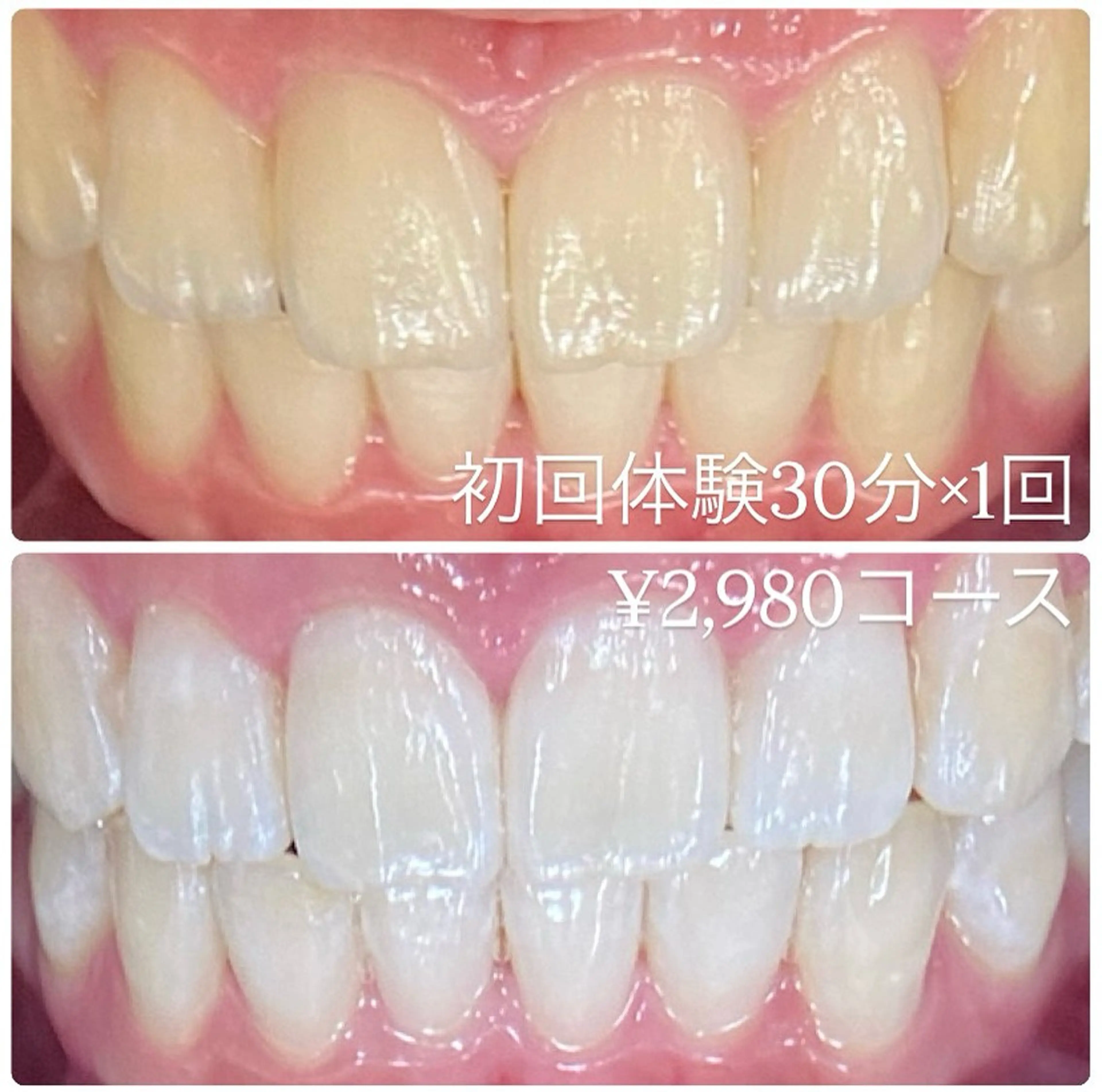 ホワイトニングルーム 横浜店のその他イメージ