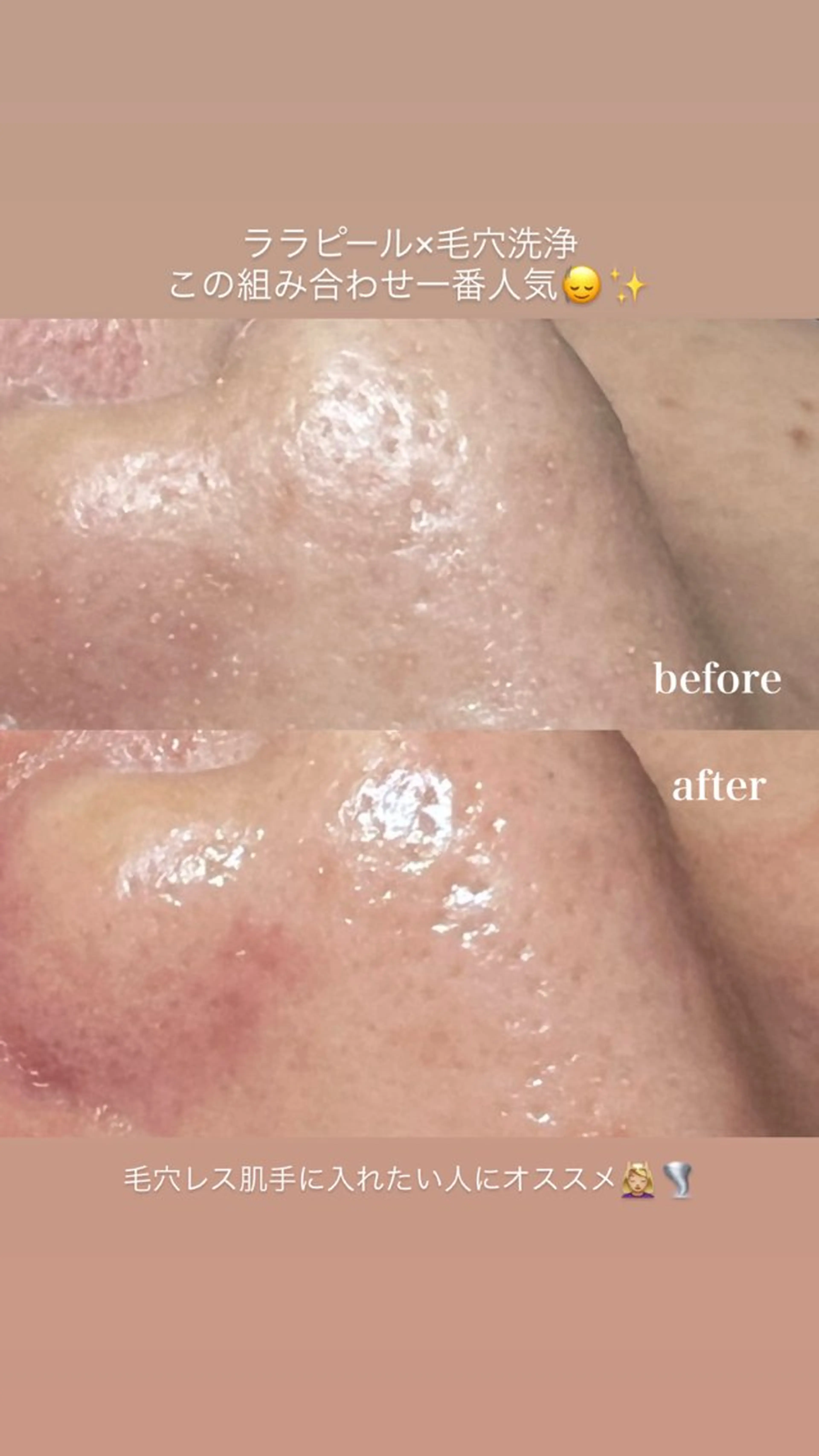 エステ 🌿hitomi🌿 艶肌/肌質改善のエステ・リラクイメージ