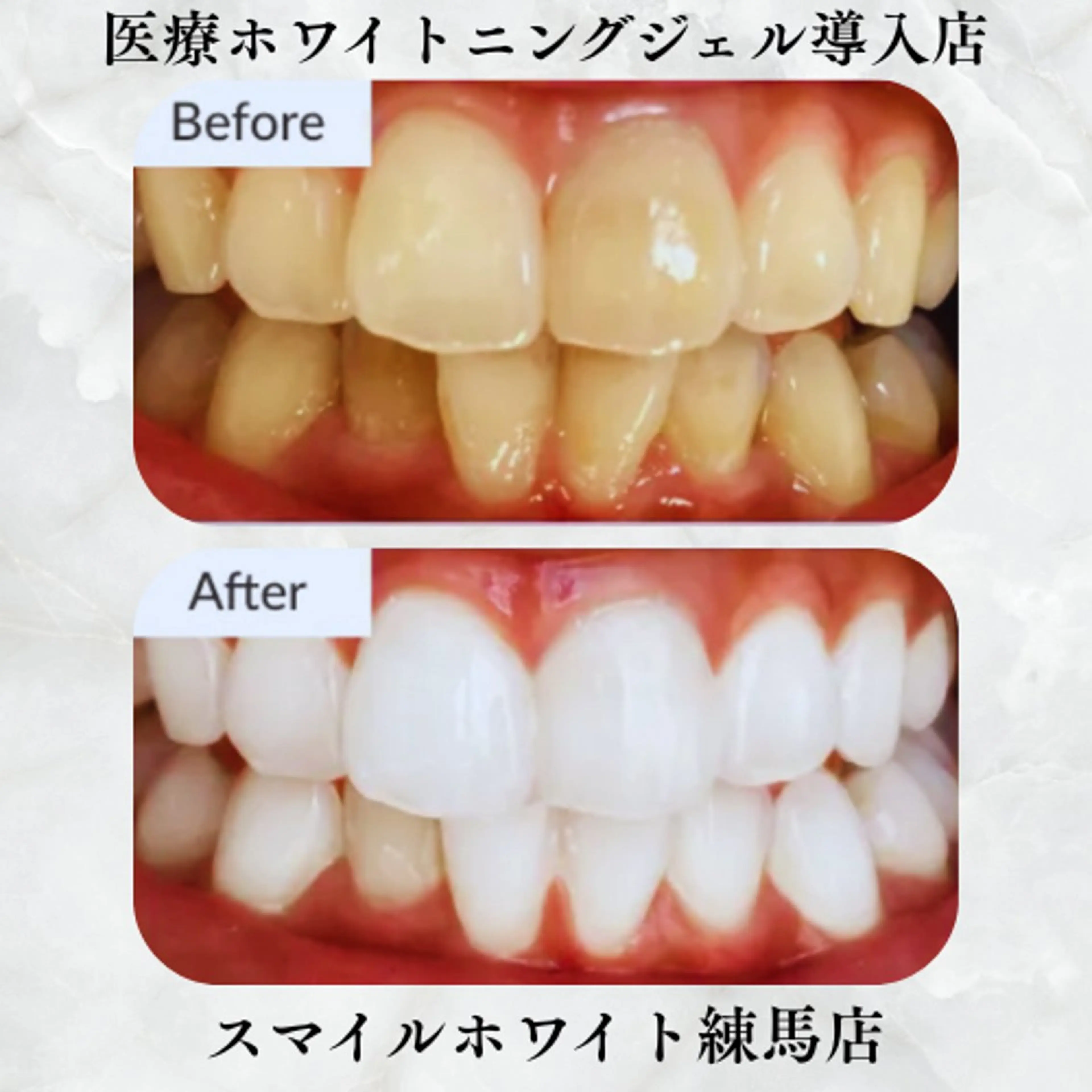 アイブロウ スマイルホワイト 赤羽店のエステ・リラクイメージ