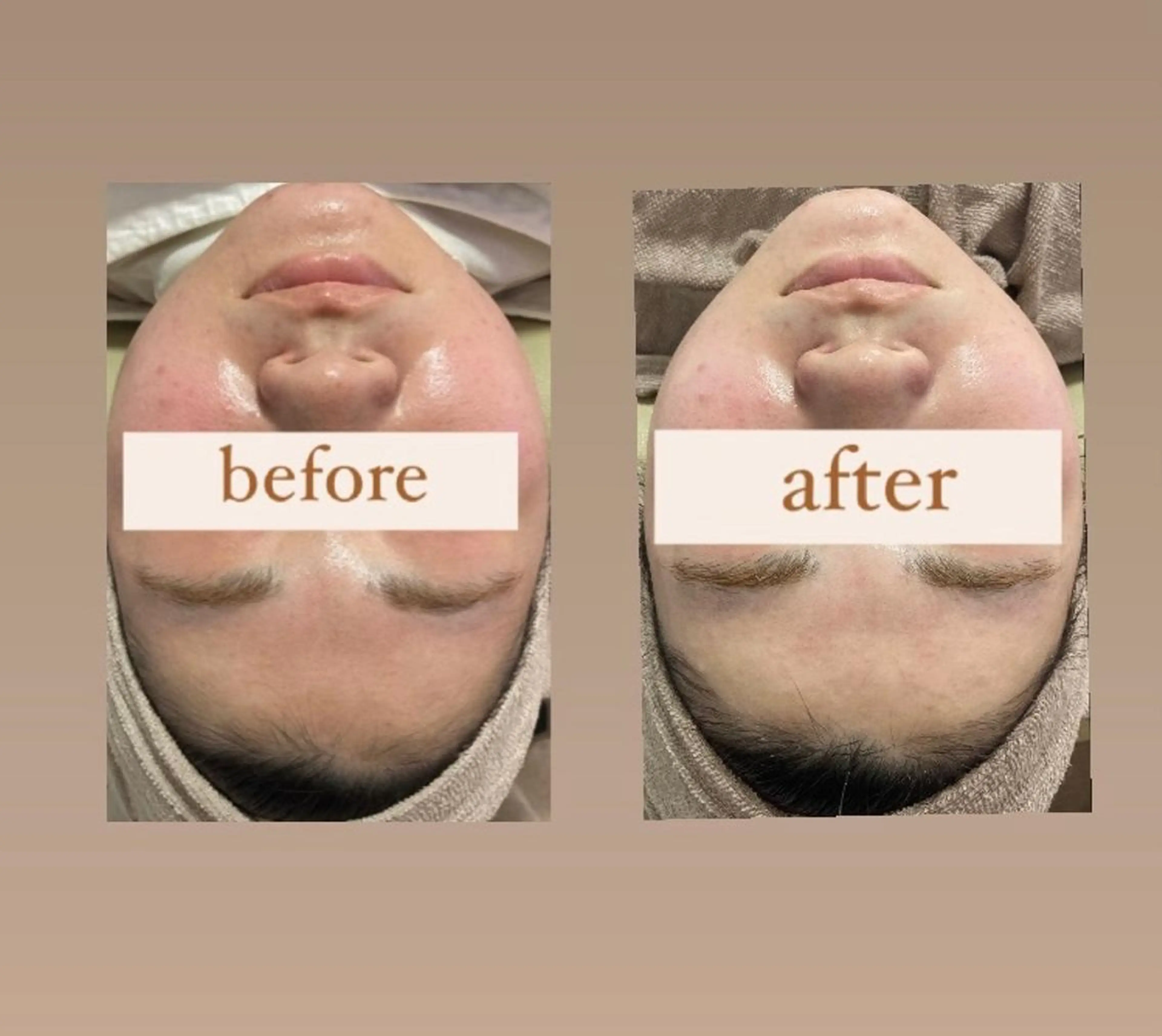 エステ 【韓国肌管理・脱毛】 クレセントのその他イメージ