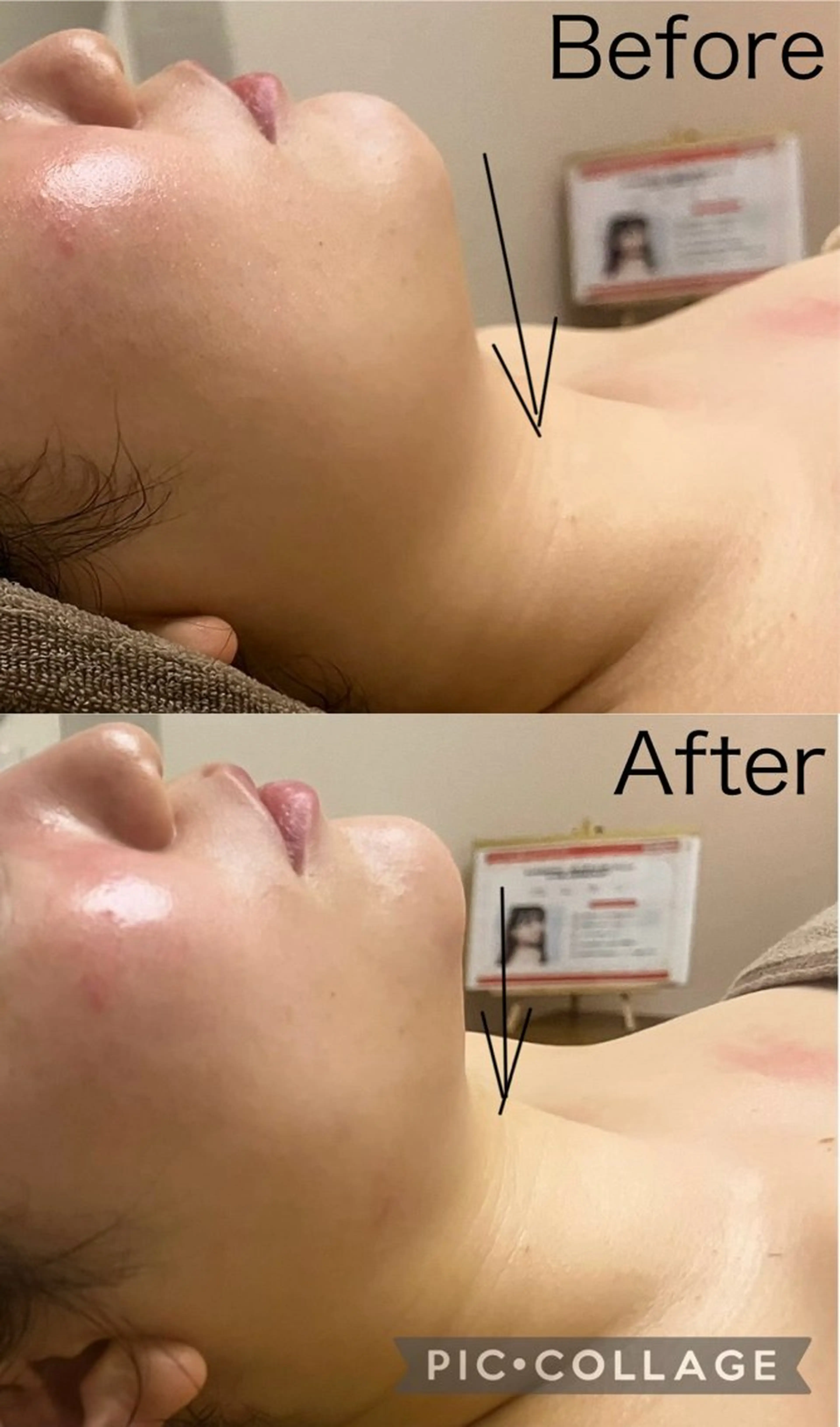 予約殺到✨次世代お顔のダイエット！話題の《レモン/ボトル🍋》口コミ必須🙏現金払いの写真