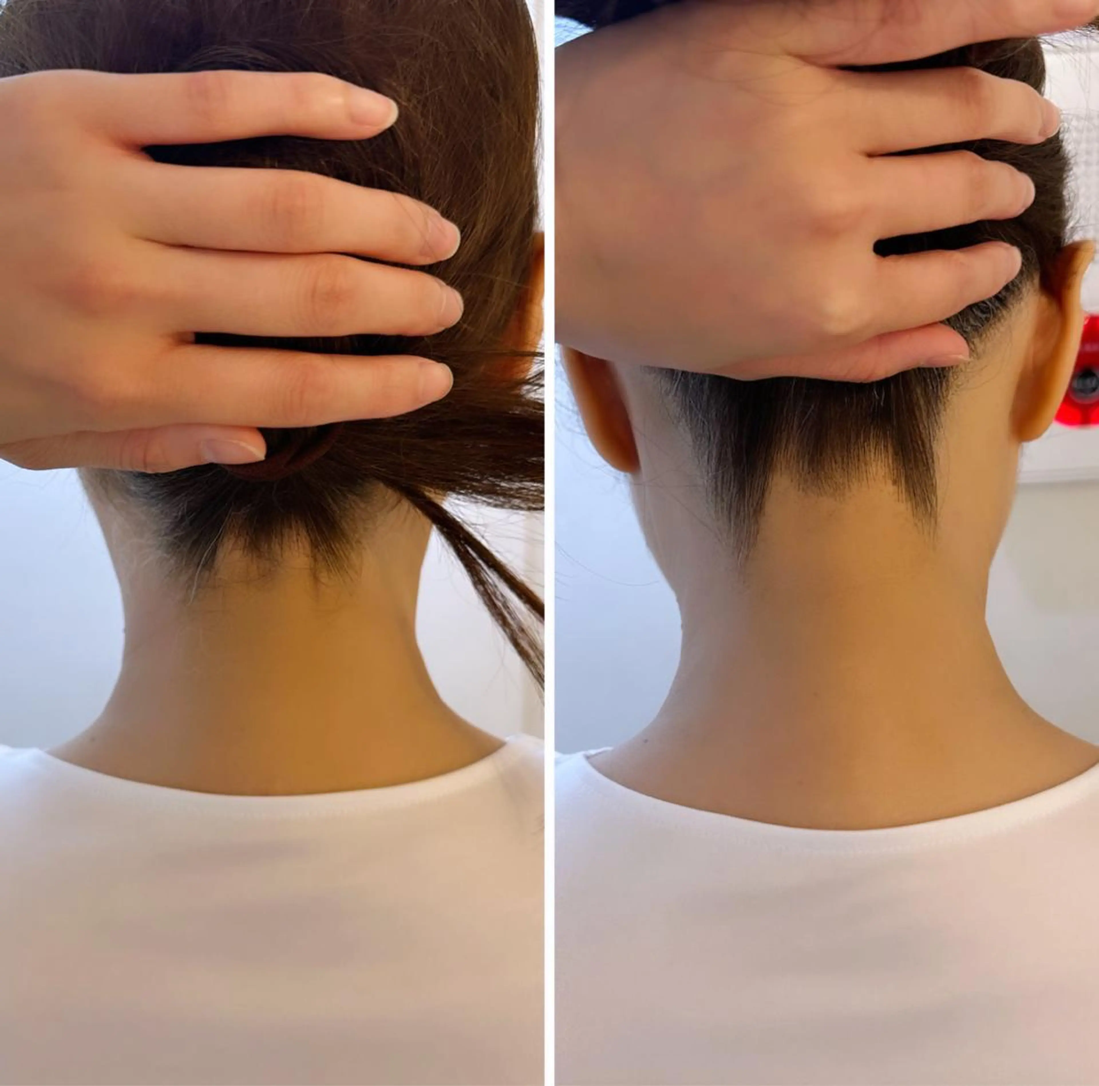 脱毛 うなじ脱毛/美肌脱毛 LABELのエステ・リラクイメージ