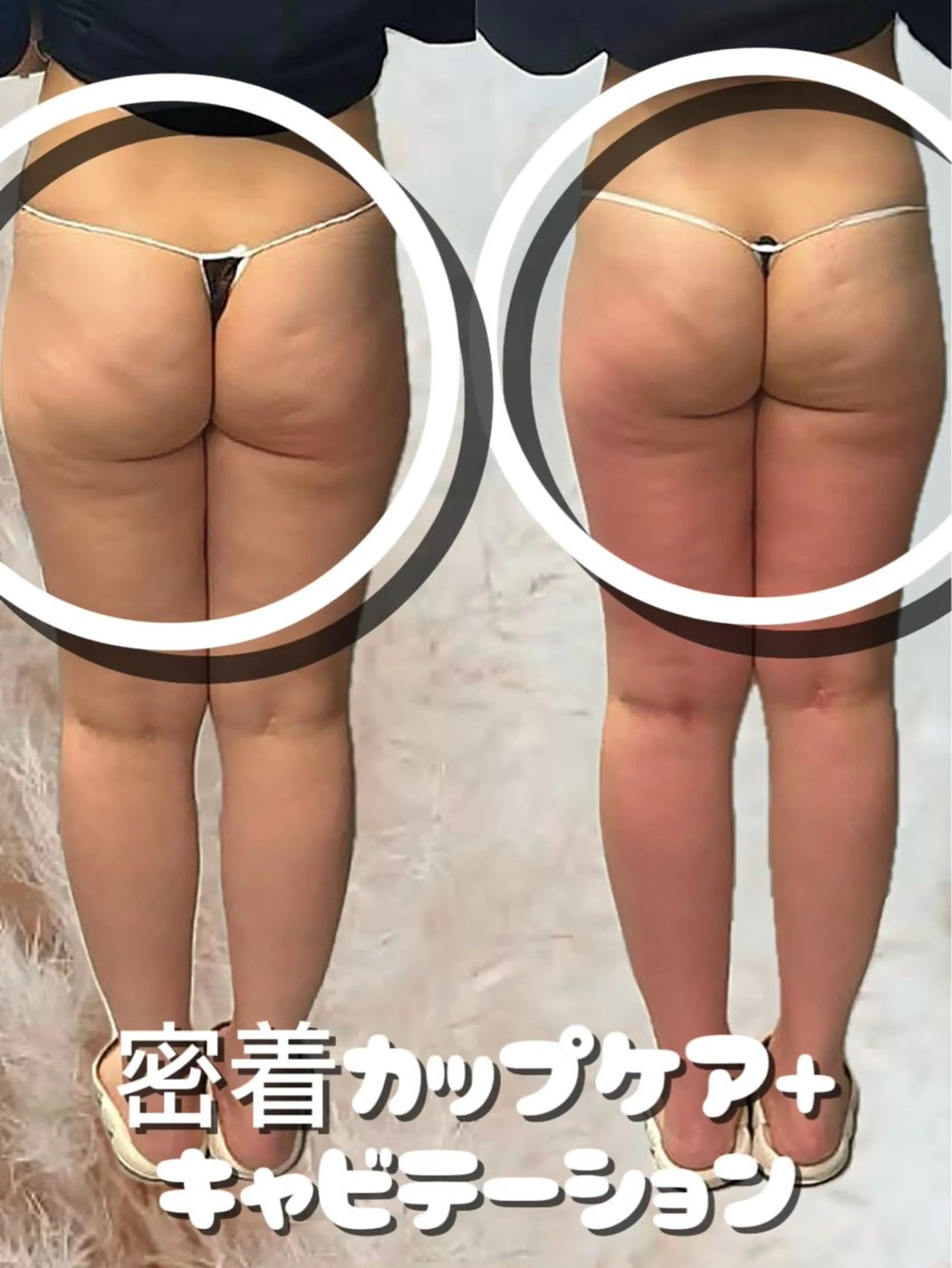 美容整体・塗る漢方・フェイシャルRechica所属・痩身・脱毛・肌管理 Rechica心斎橋のエステ・リラクイメージ