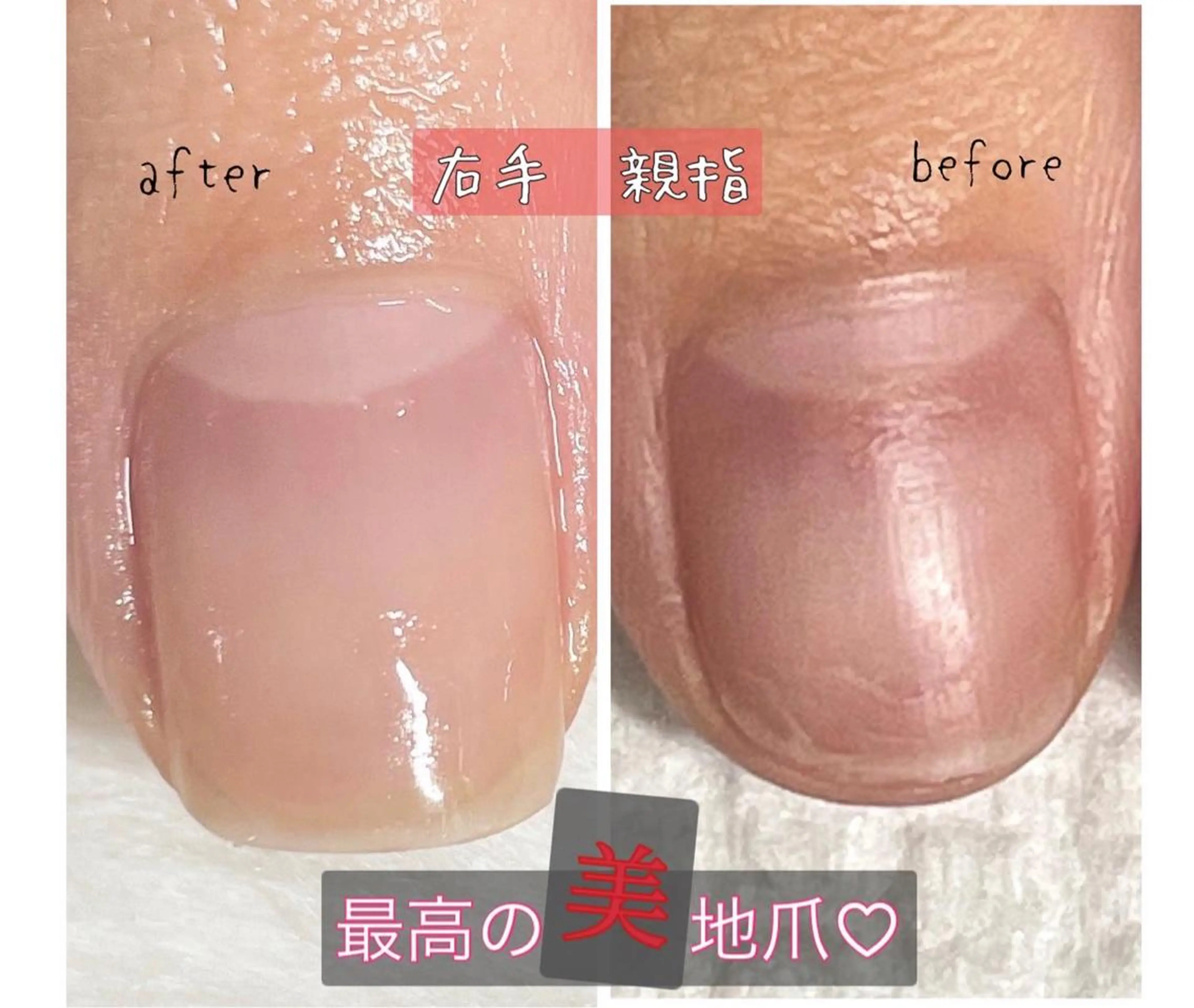 美自爪育成ケア💅コンプレックス解消🤗残席1名❗️3ヶ月間に8回のご来店です。※詳細をご覧ください♡の写真