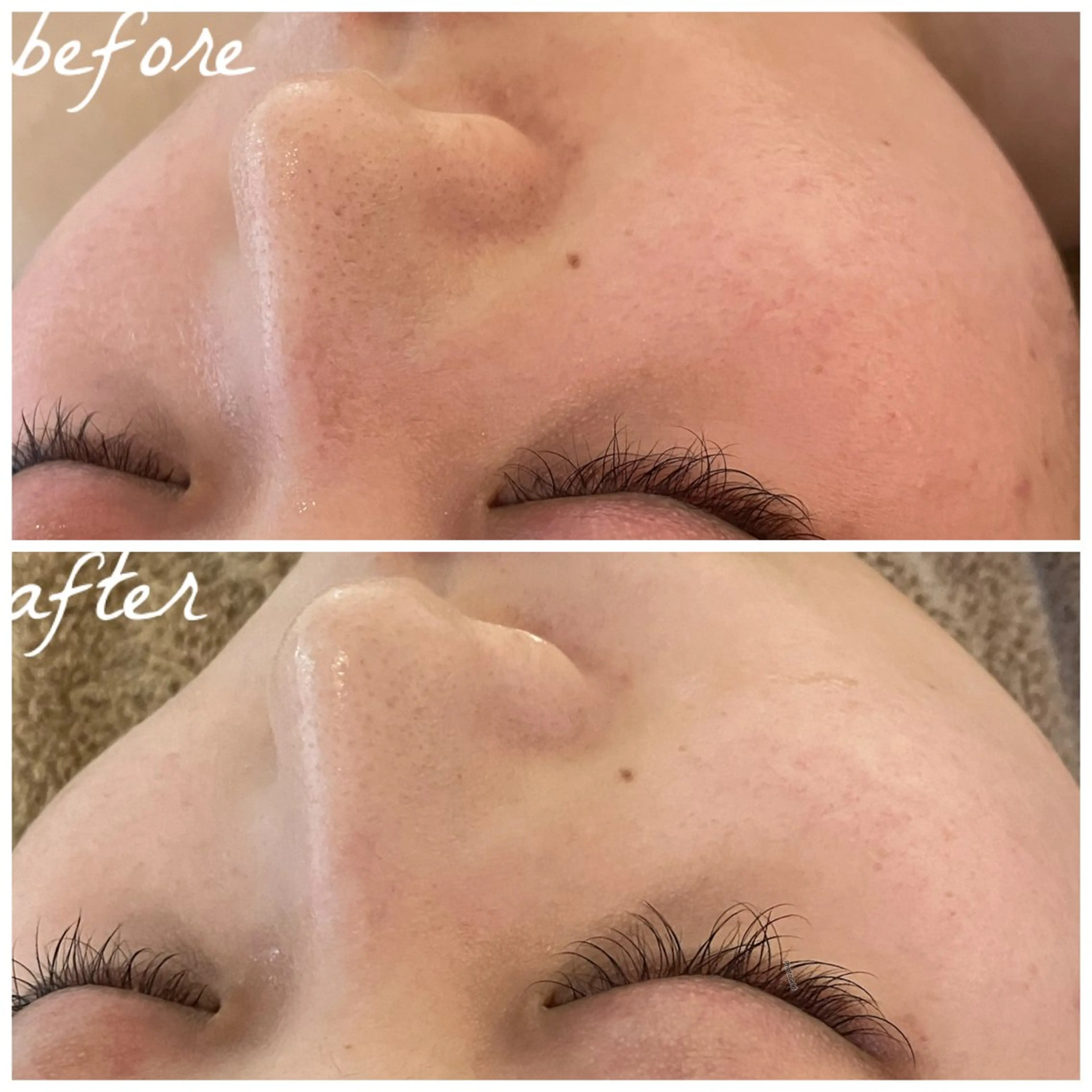 メンズ エステ メナード岐阜市茜部 杉浦のエステ・リラクイメージ