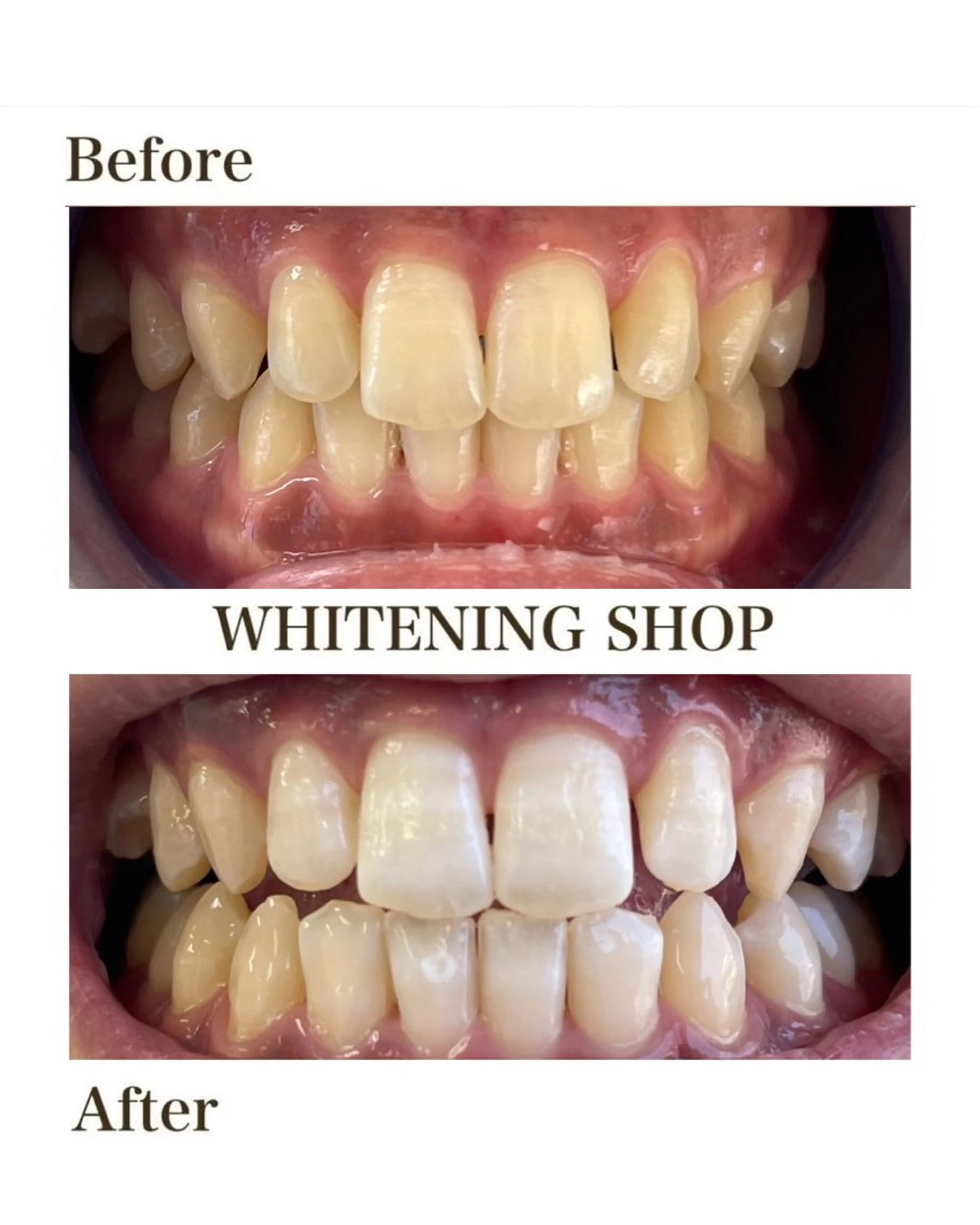 ホワイトニング ショップ津店のその他イメージ