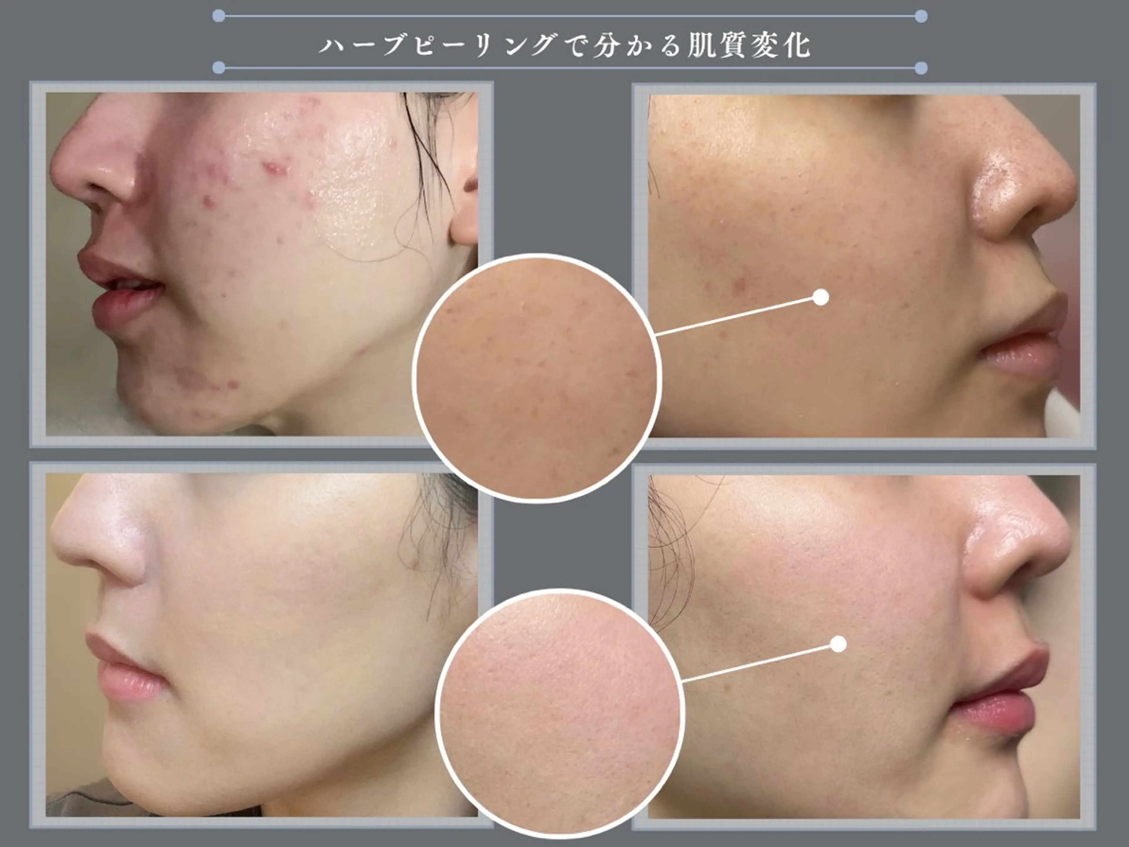 【肌質ケアサロン】 RUMINIRのエステ・リラクイメージ