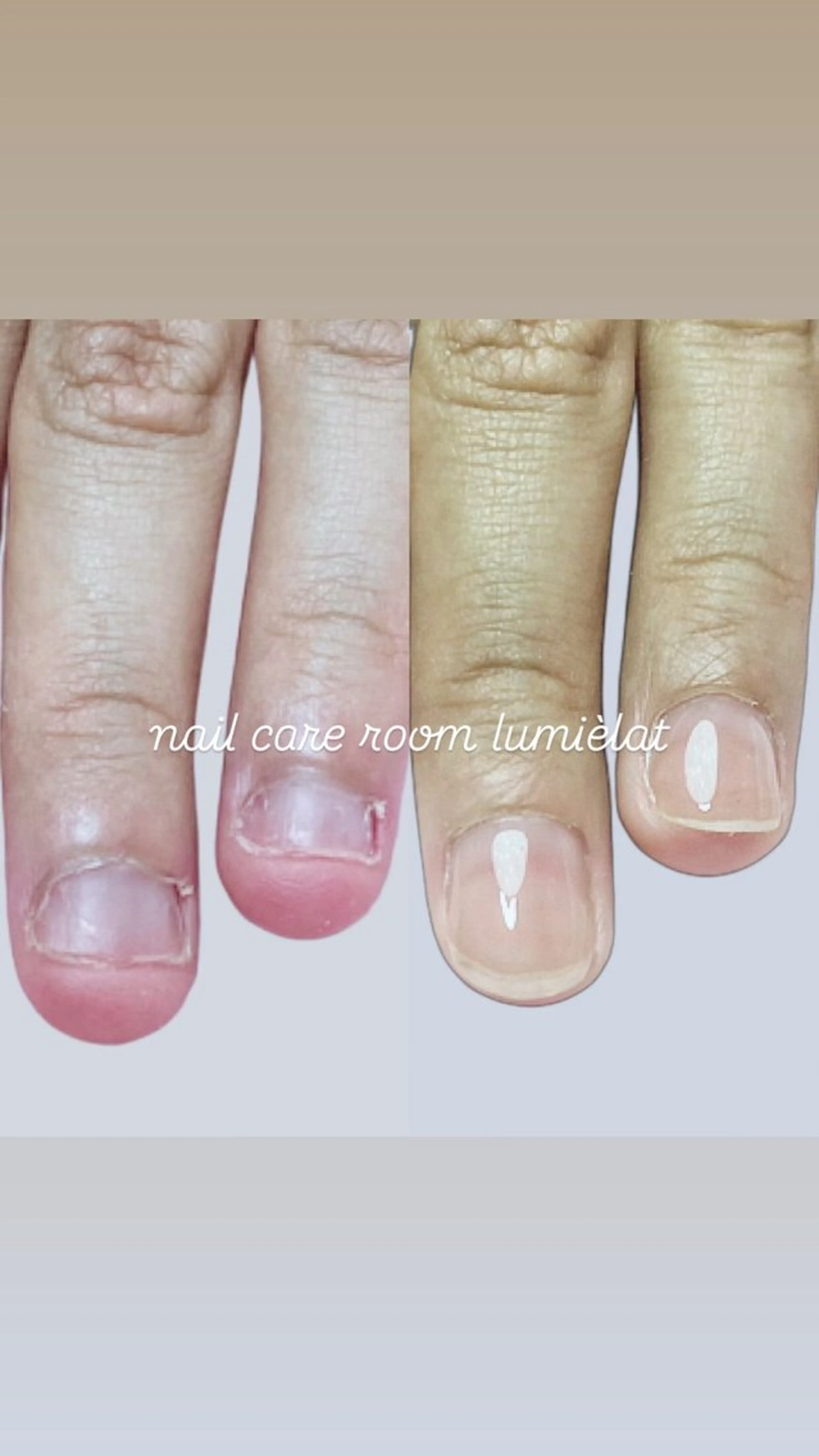 ネイル 深爪育成専門nail _Lumièlatのネイルデザイン