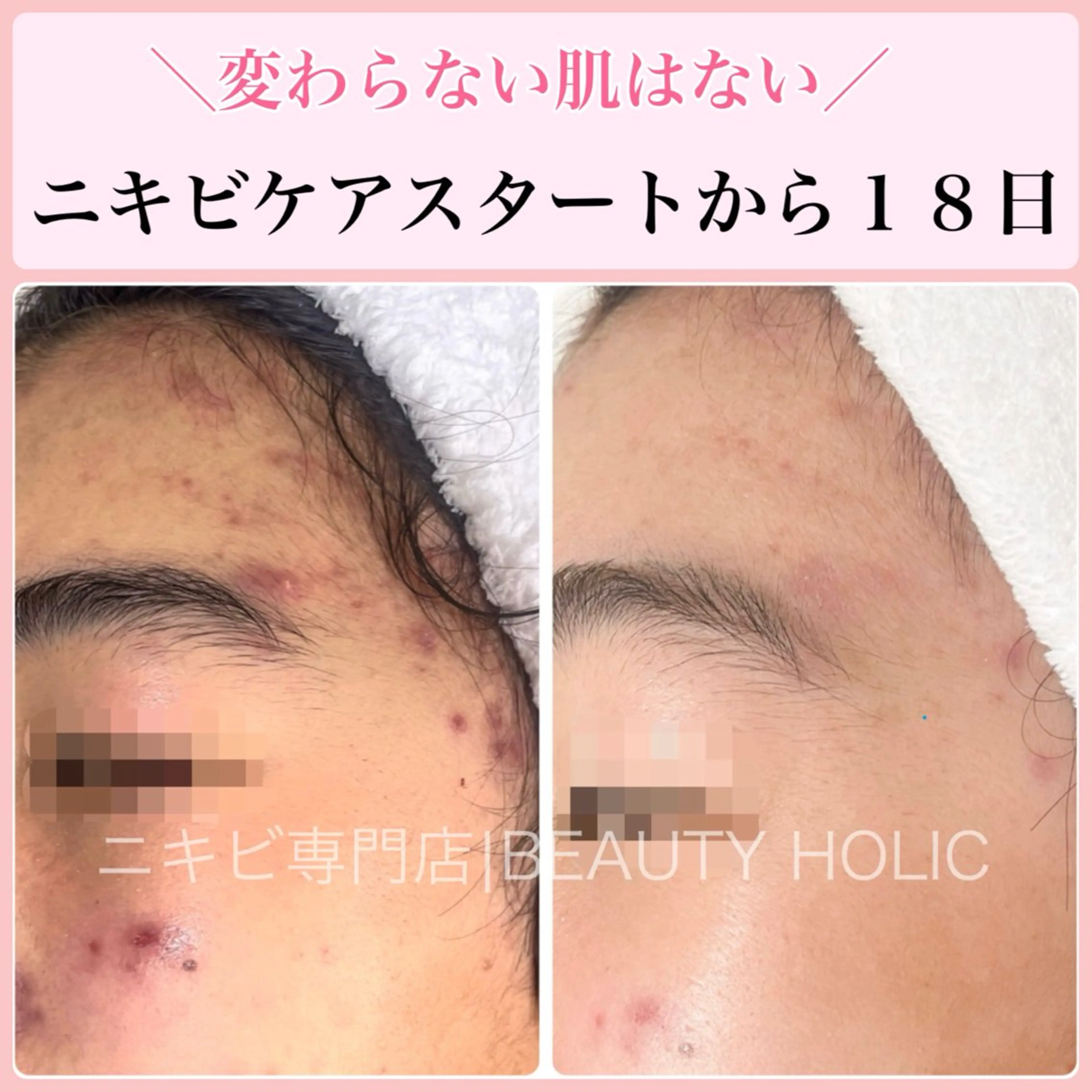 エステ リラク ニキビ・ 肌荒れ専門店のエステ・リラクイメージ