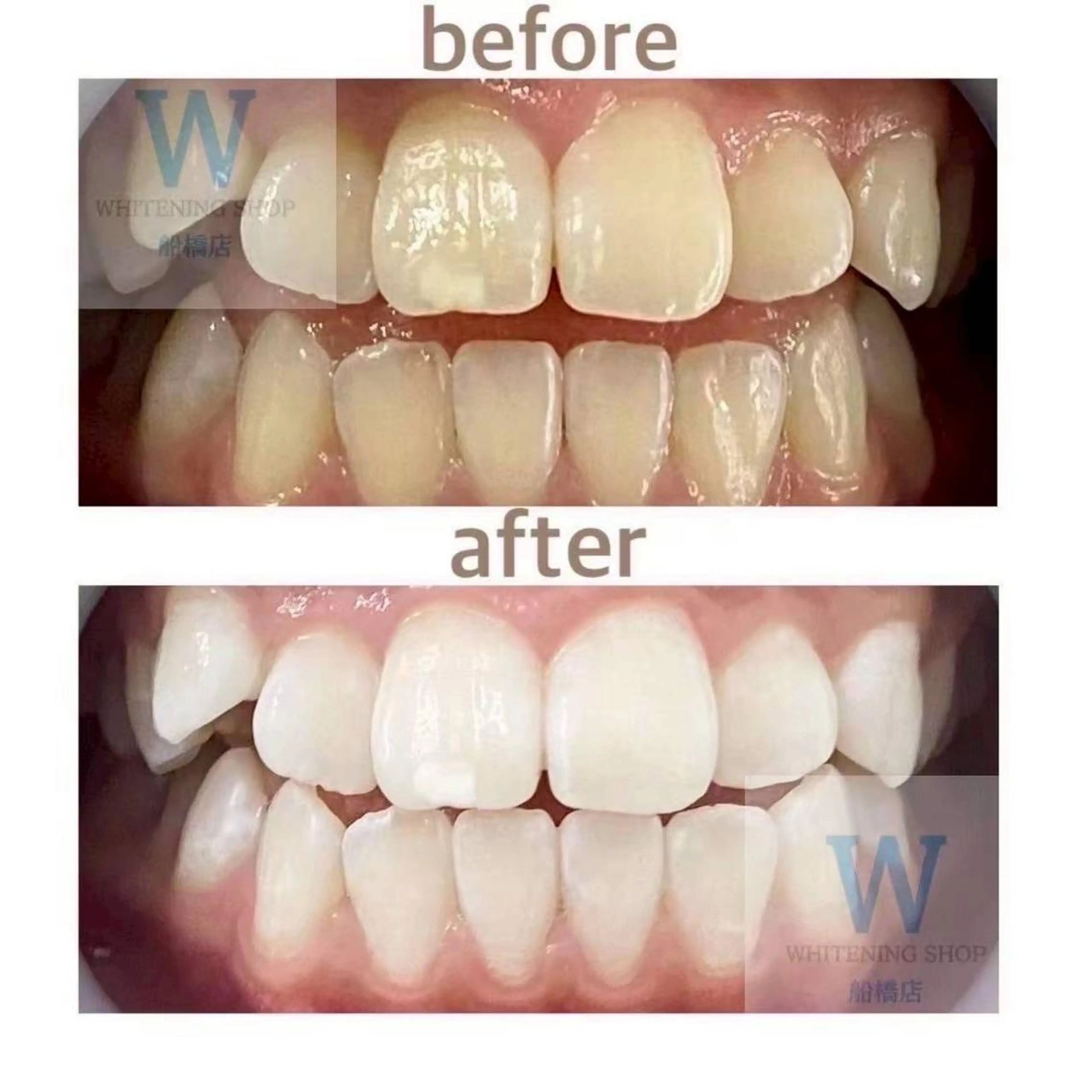 ホワイトニング ショップ船橋２号店のエステ・リラクイメージ