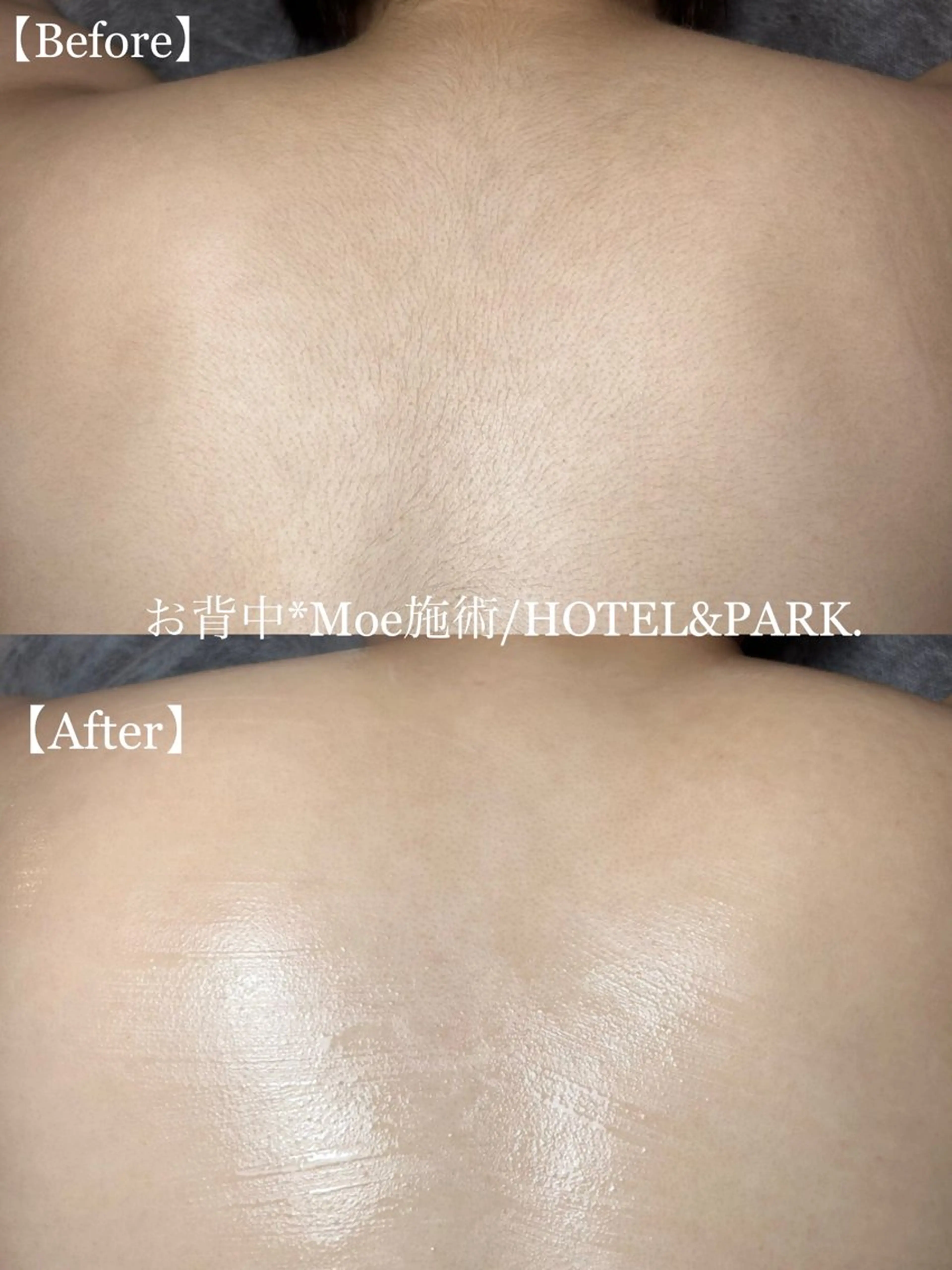 HOTEL&PARK . ワックス脱毛のエステ・リラクイメージ