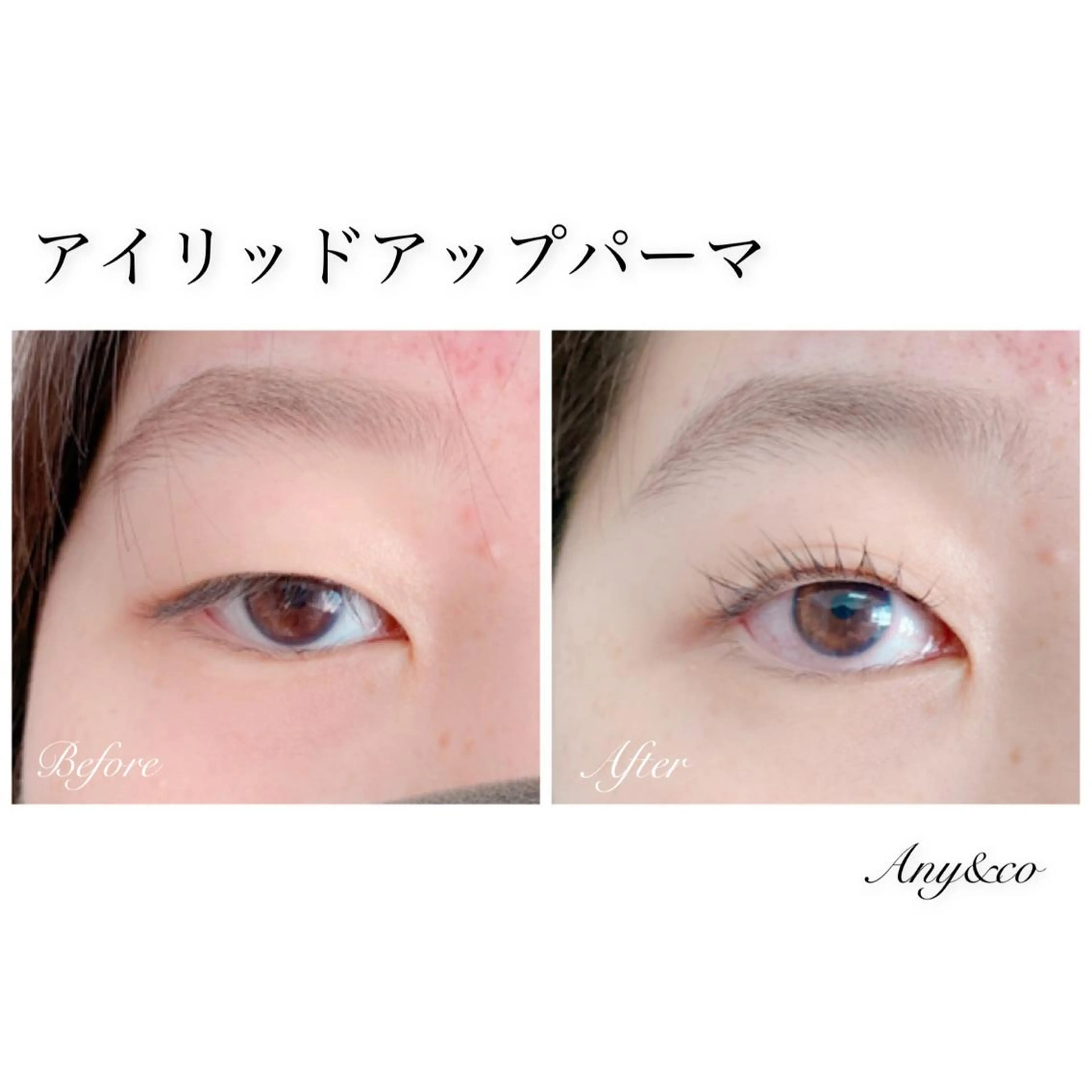 マツエク・マツパ アイリッドアップパーマ Any&co 【エニコ】のマツエク・マツパデザイン