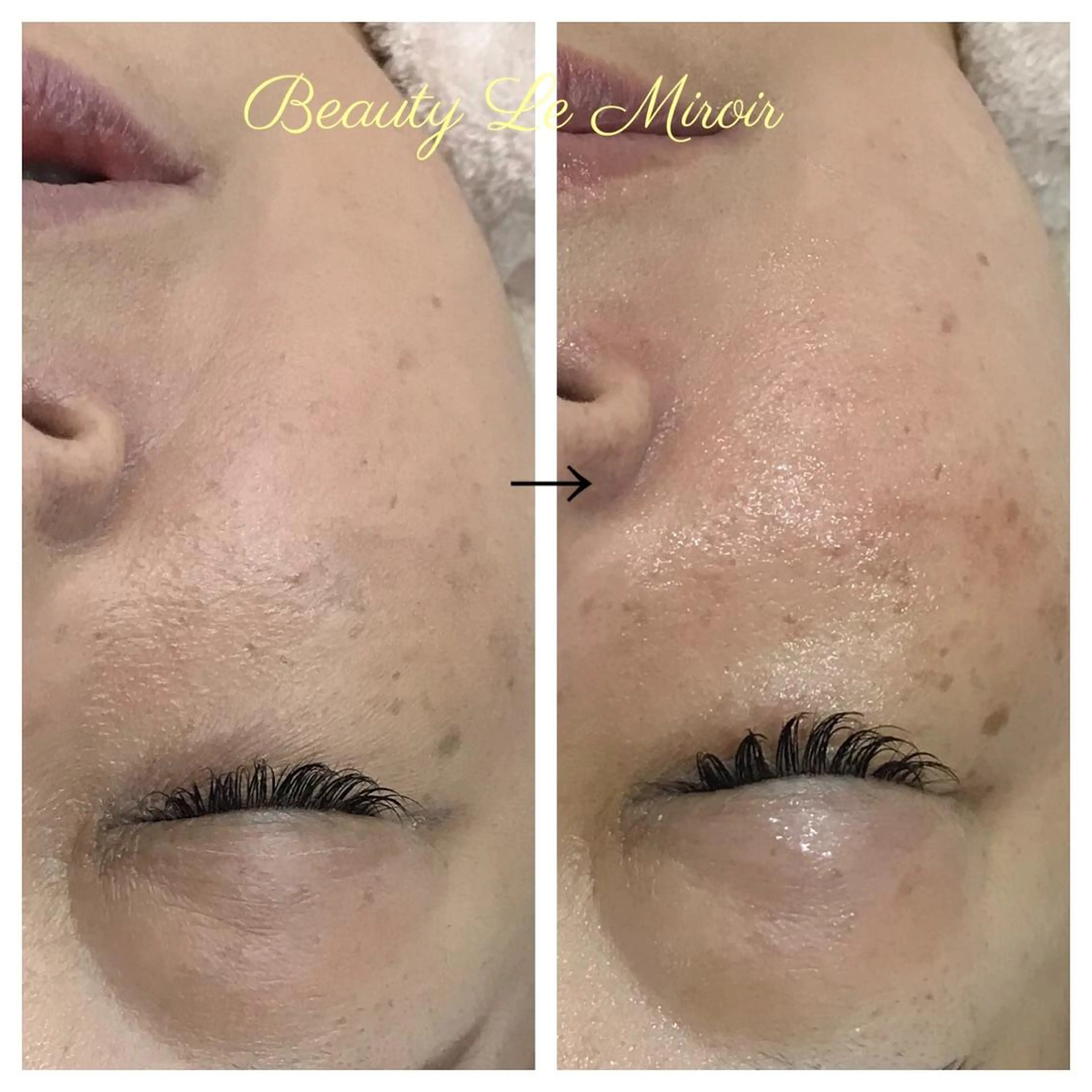 ビューティー ミロワールのエステ・リラクイメージ