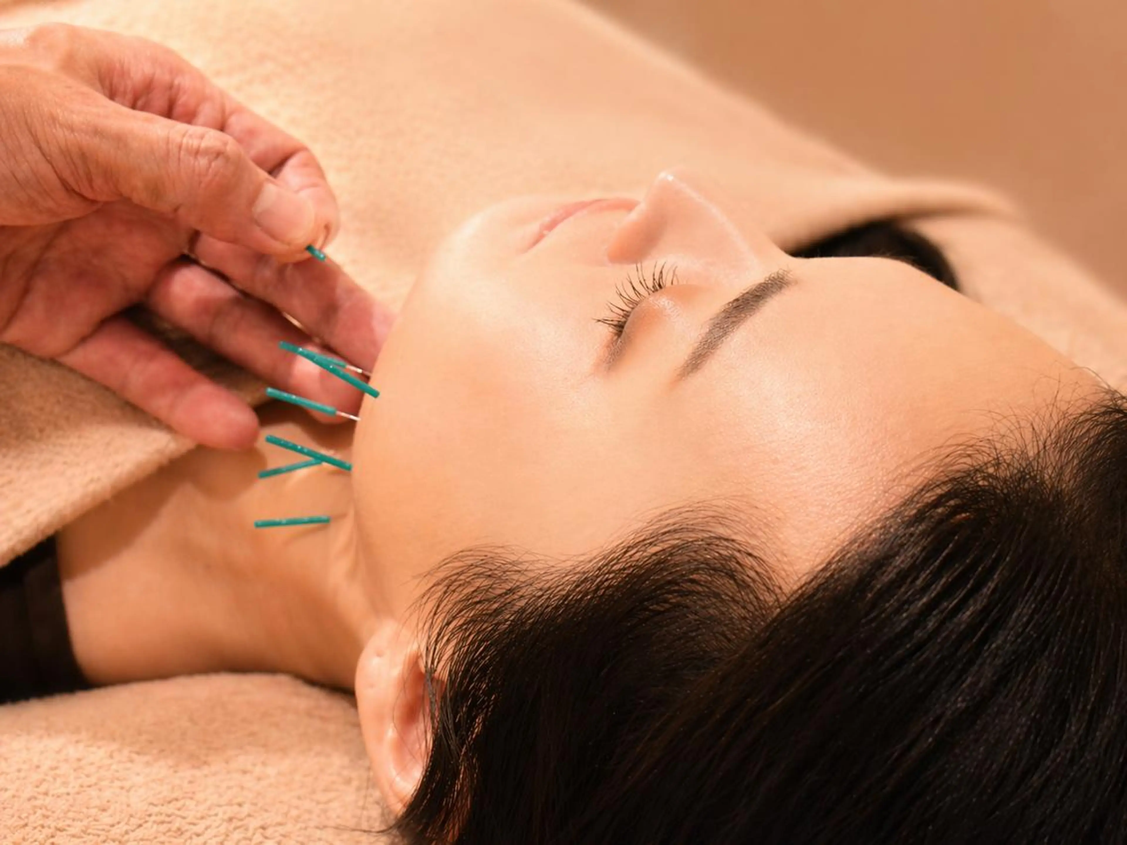 初回人気No.1｜顎・食いしばりまでみる小顔矯正＋美容鍼の写真