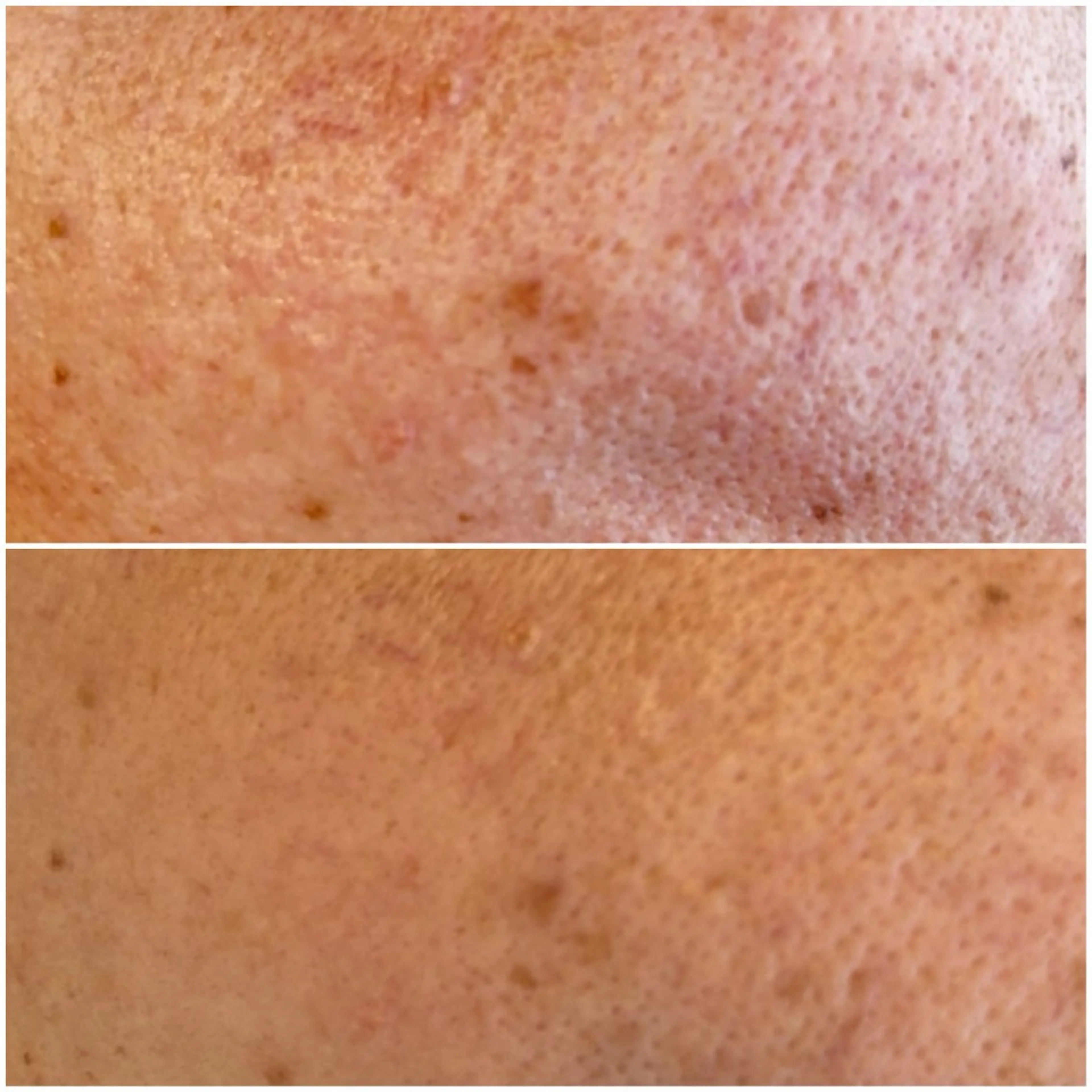 エステサロンMee. 大畑のエステ・リラクイメージ