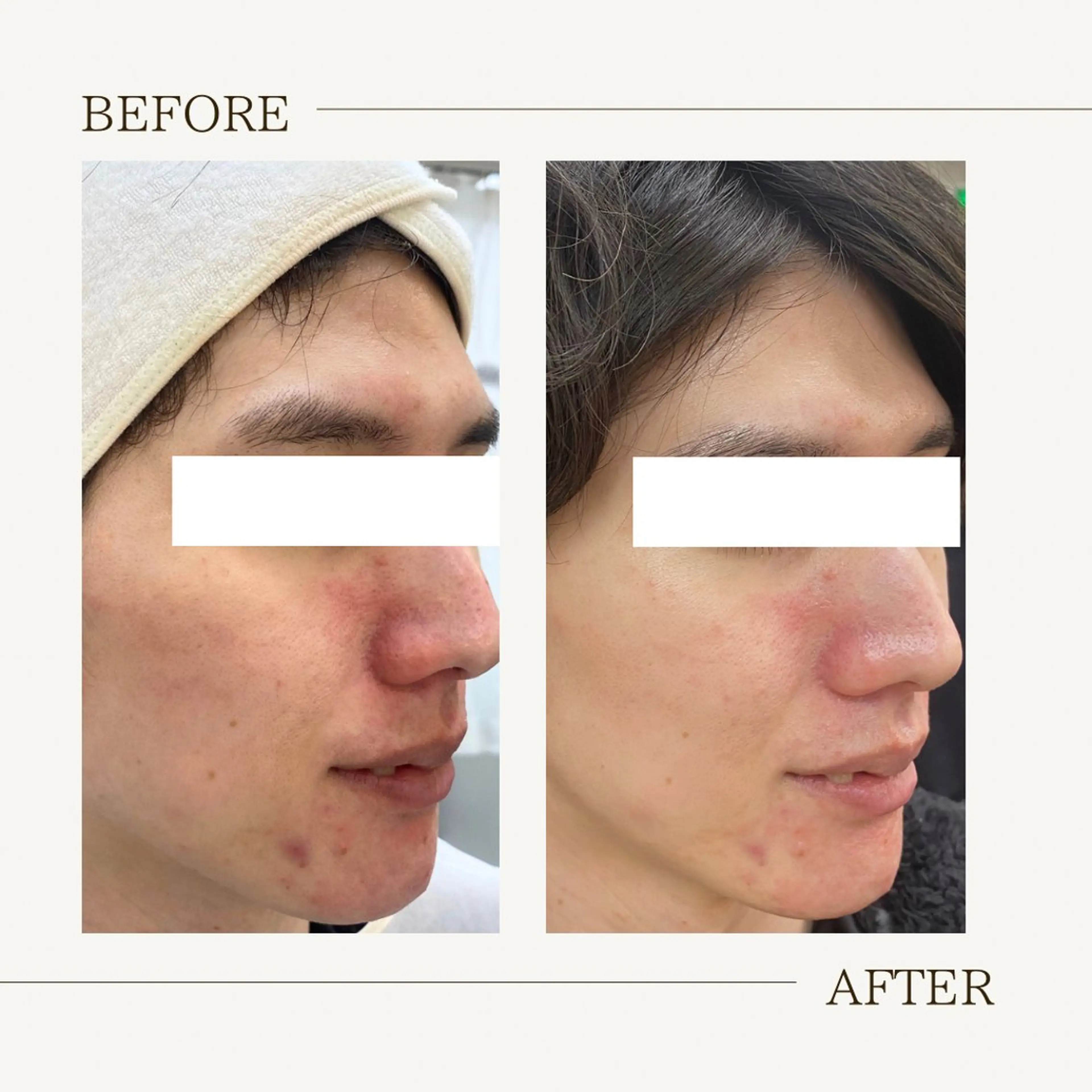 肌育成サロン ♡ RISAのエステ・リラクイメージ