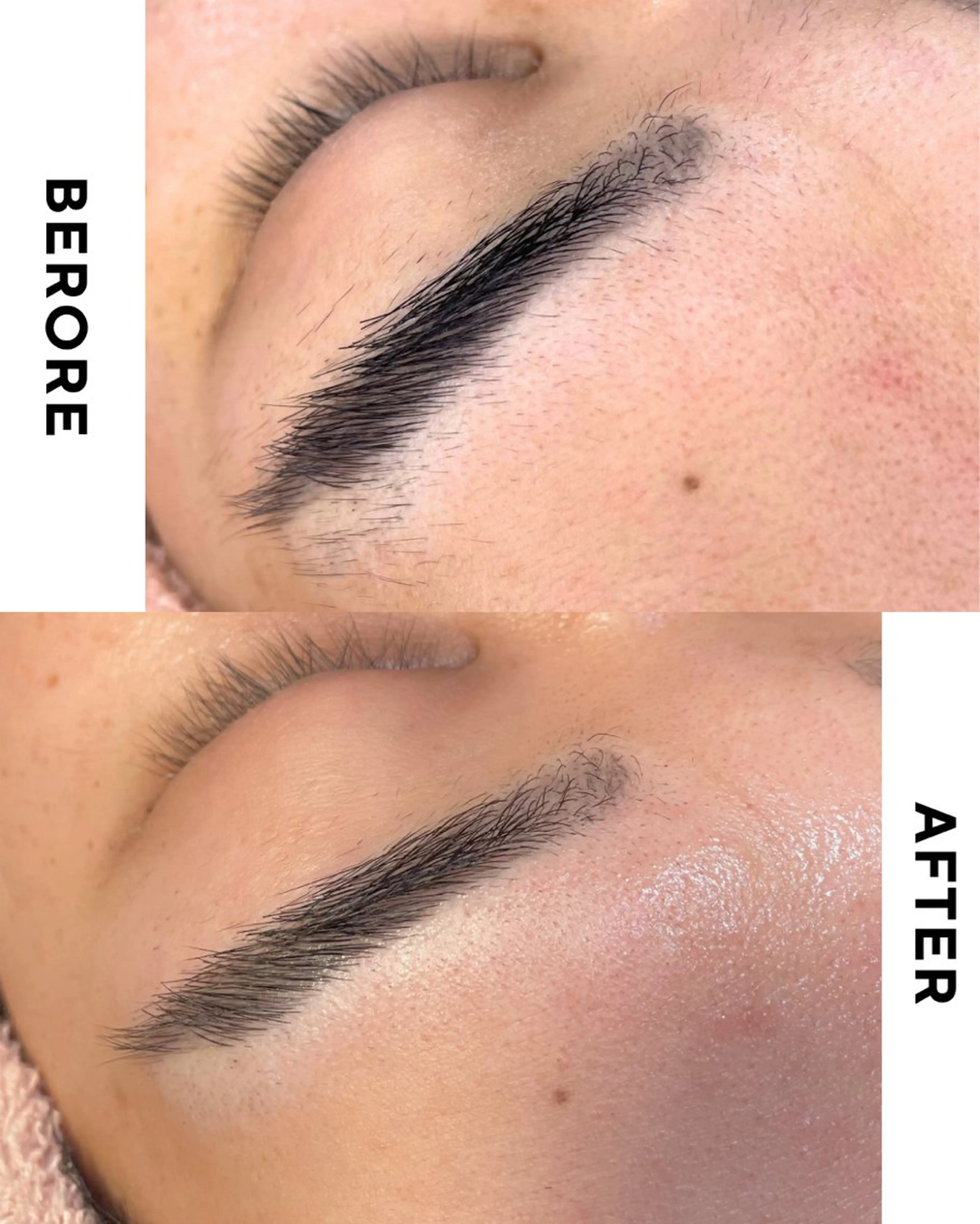 脱毛 肌質改善専門サロン Bellmi/心斎橋のエステ・リラクイメージ