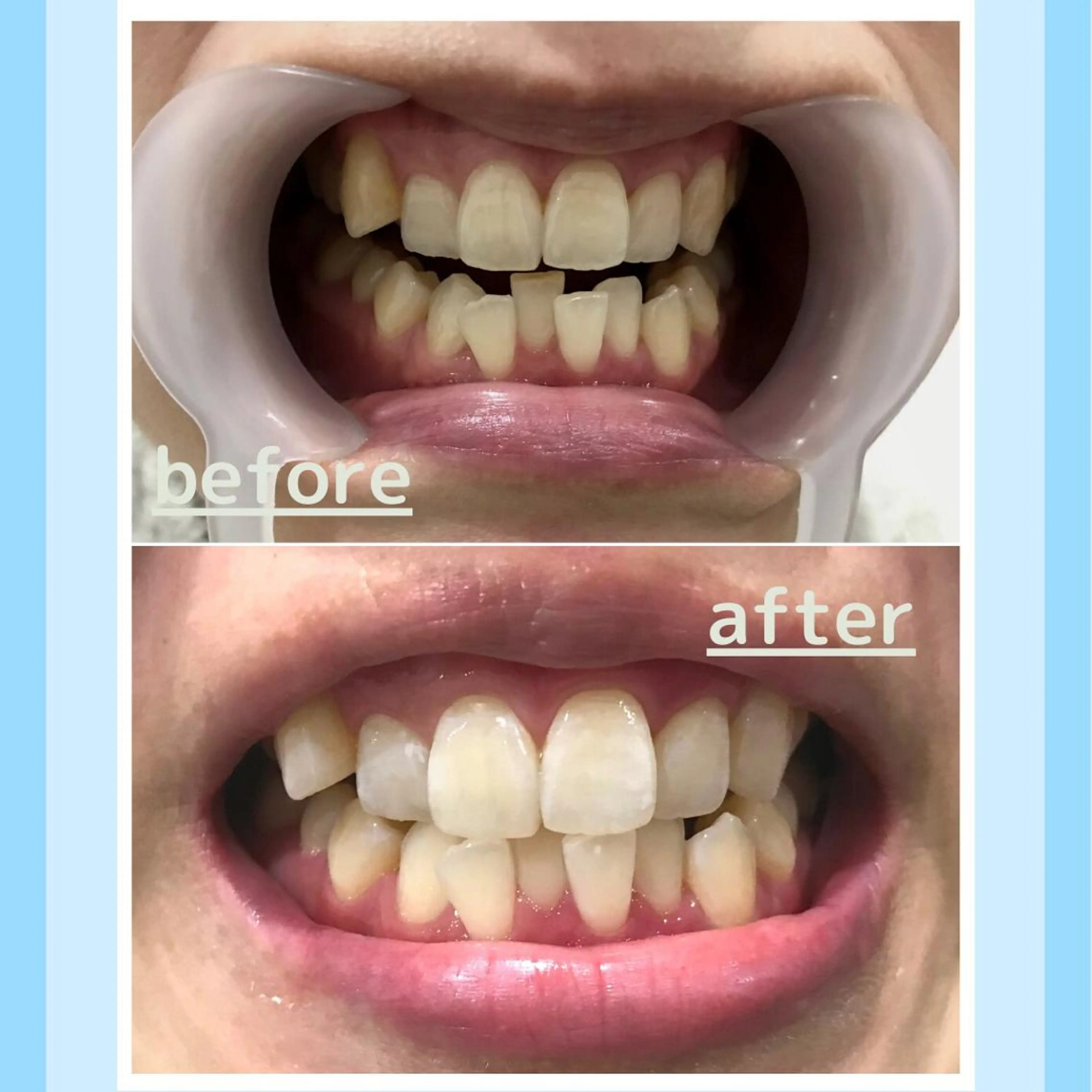 メンズ お手軽ホワイトニングsalon mina所属・武元 奈津美のその他イメージ