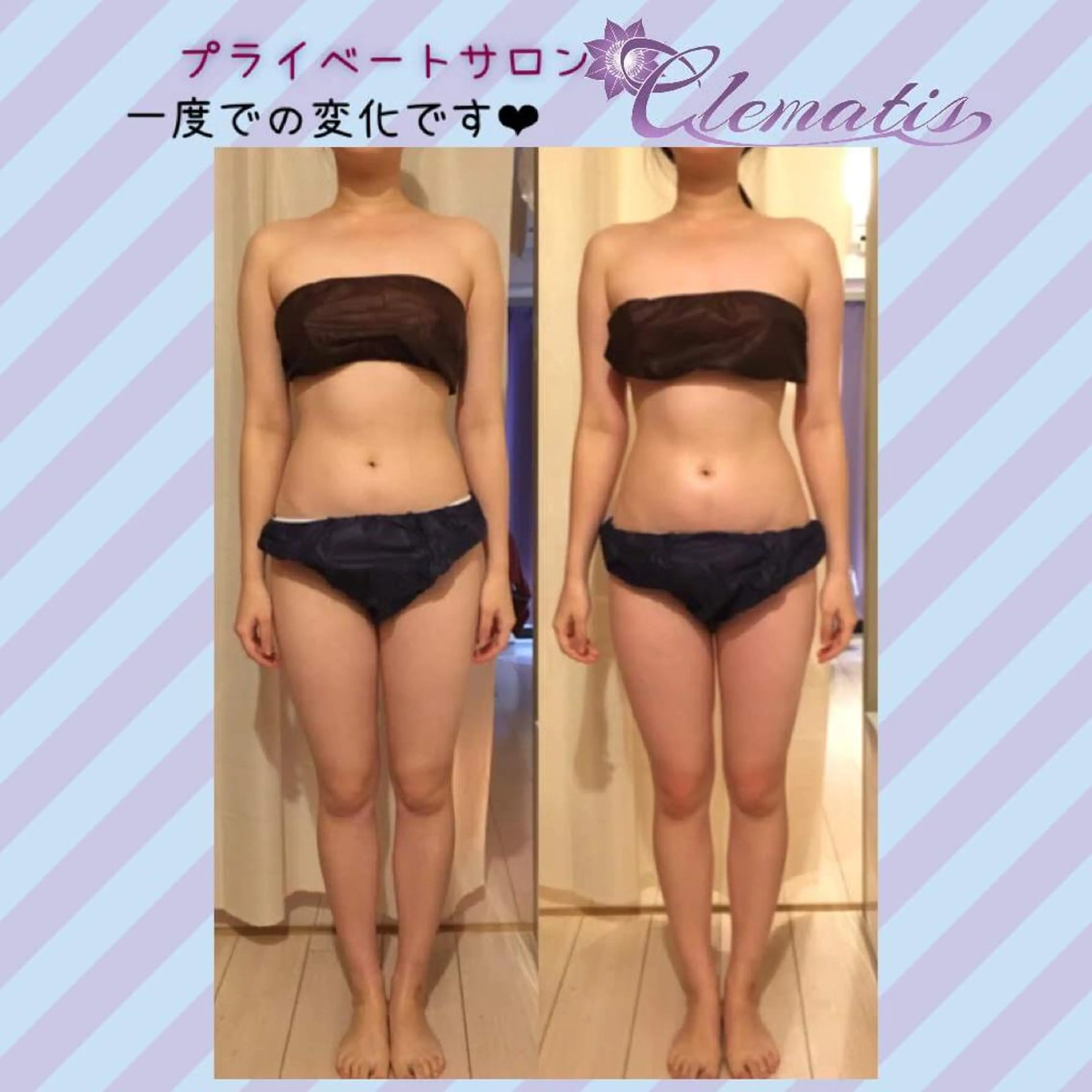 ショート カラー パーマ ヘアアレンジ メンズ キッズ ネイル マツエク・マツパ 強圧オールハンド痩身&黄土よもぎ蒸しプライベートサロンClematis池袋所属・強圧オールハンド痩身 片野のエステ・リラクイメージ