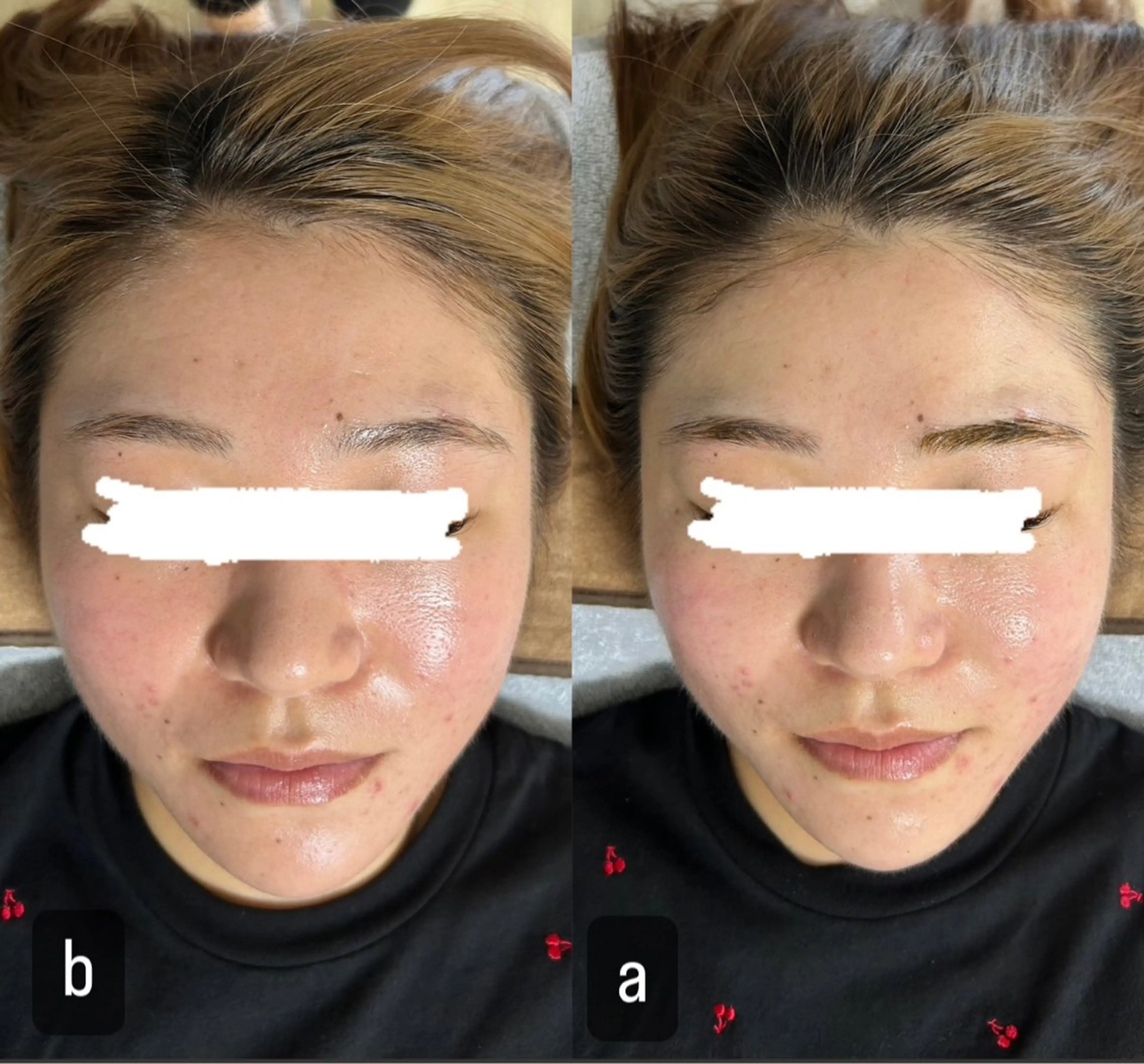 217 ホワイトニングルームのエステ・リラクイメージ