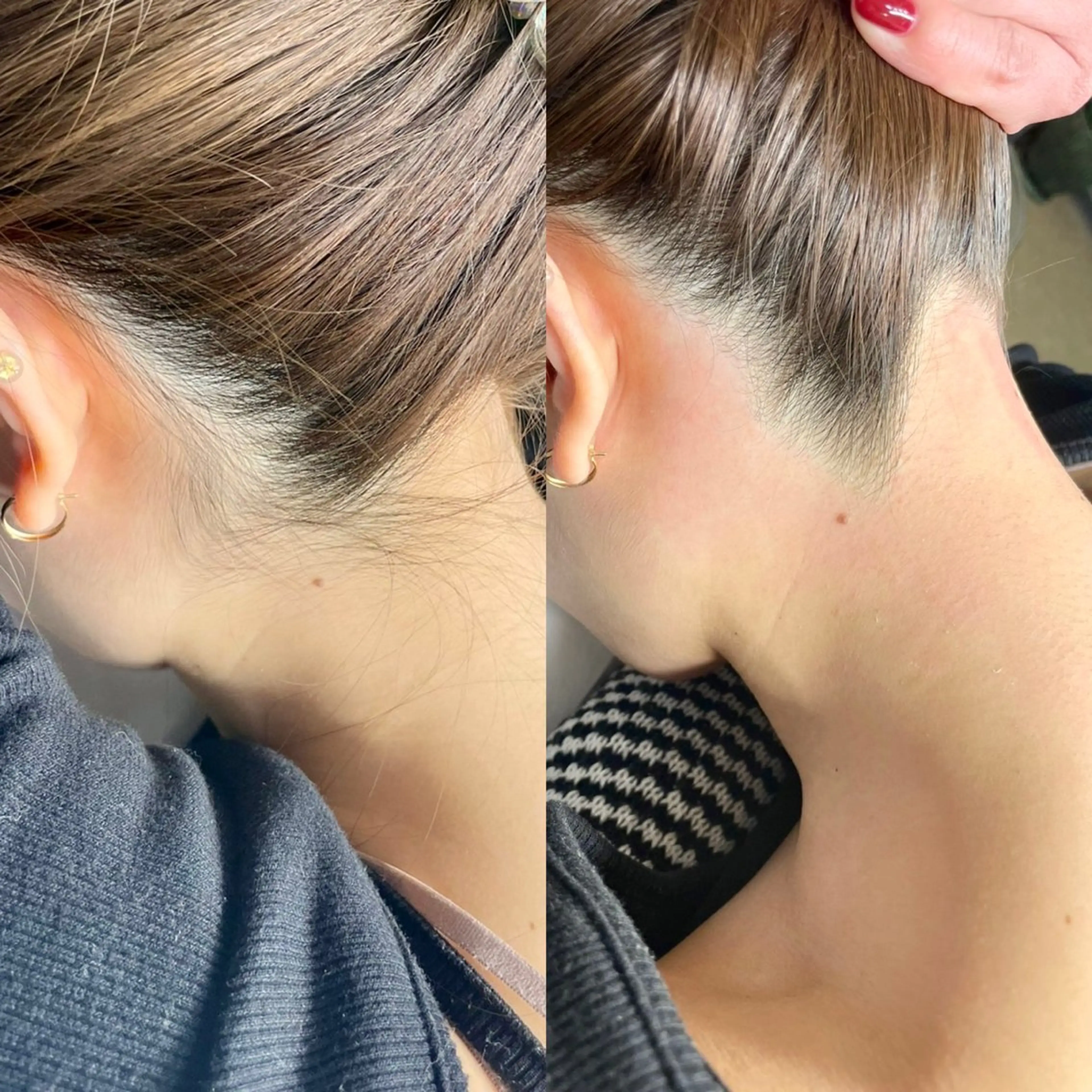 🌈【セットメニュー】ハリウッドブロウリフト＋うなじwax脱毛の写真