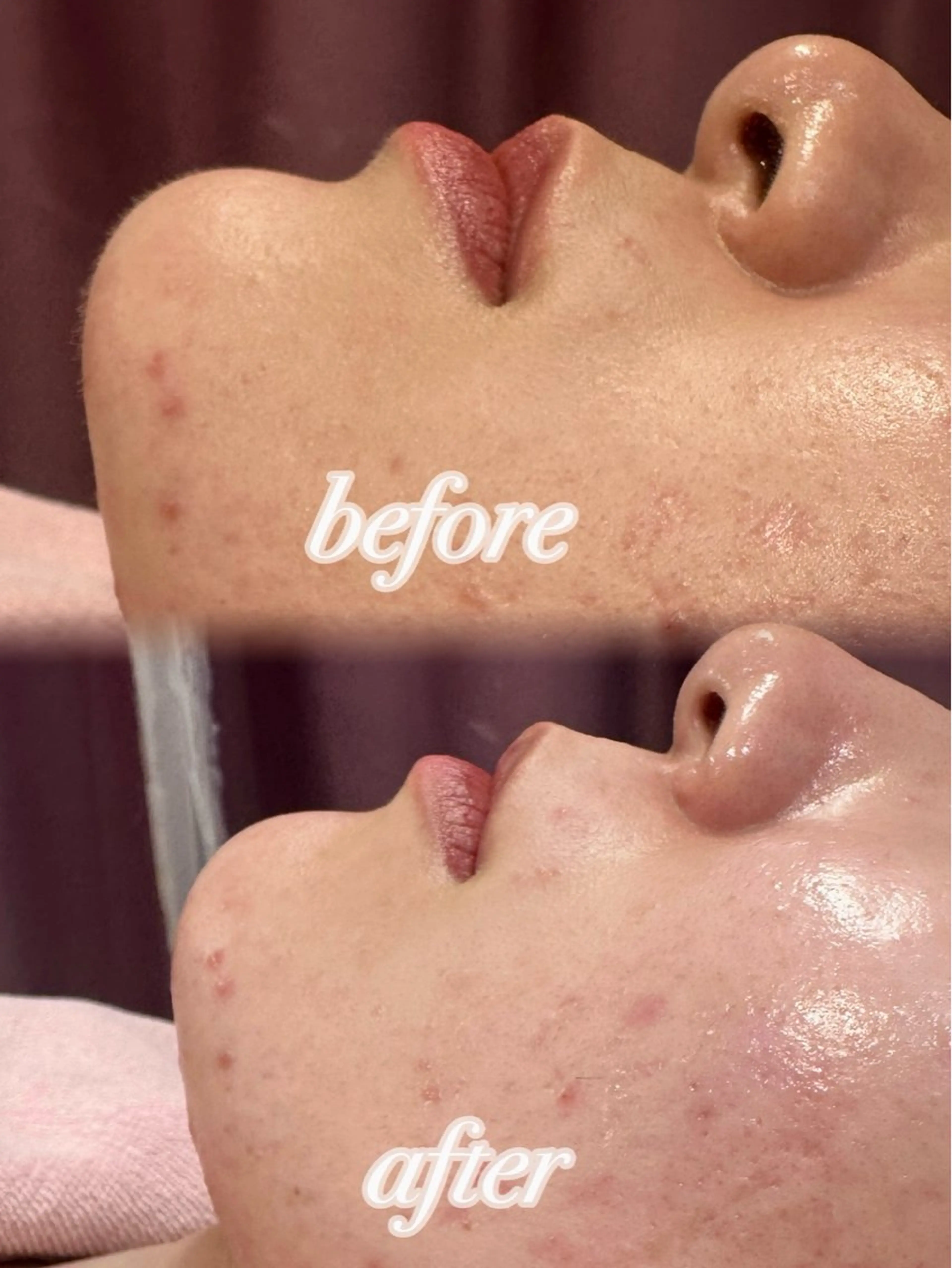 その他 ぷる艶肌🫧 shaving斉藤のその他イメージ