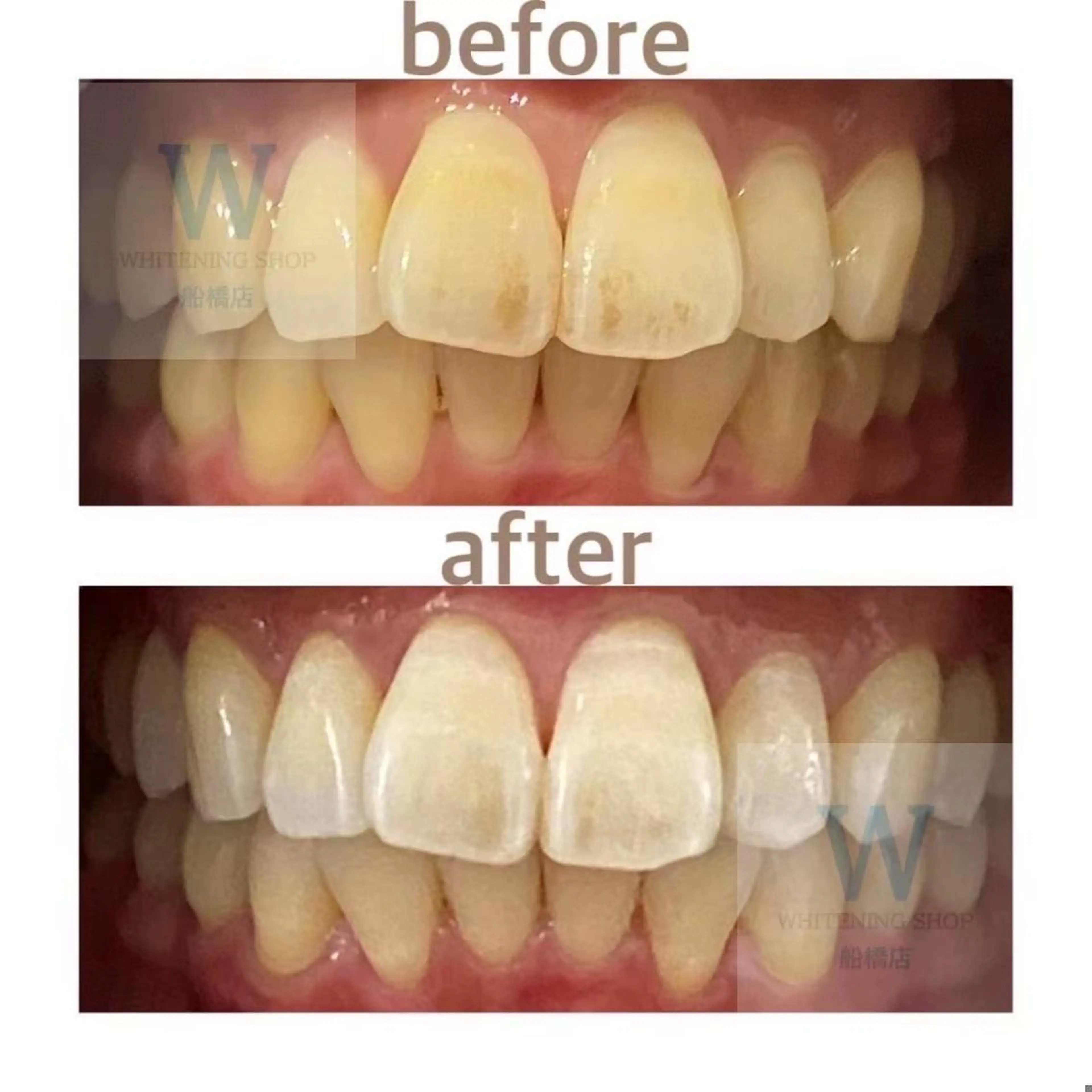 エステ リラク ホワイトニング ショップ船橋店🦷のエステ・リラクイメージ