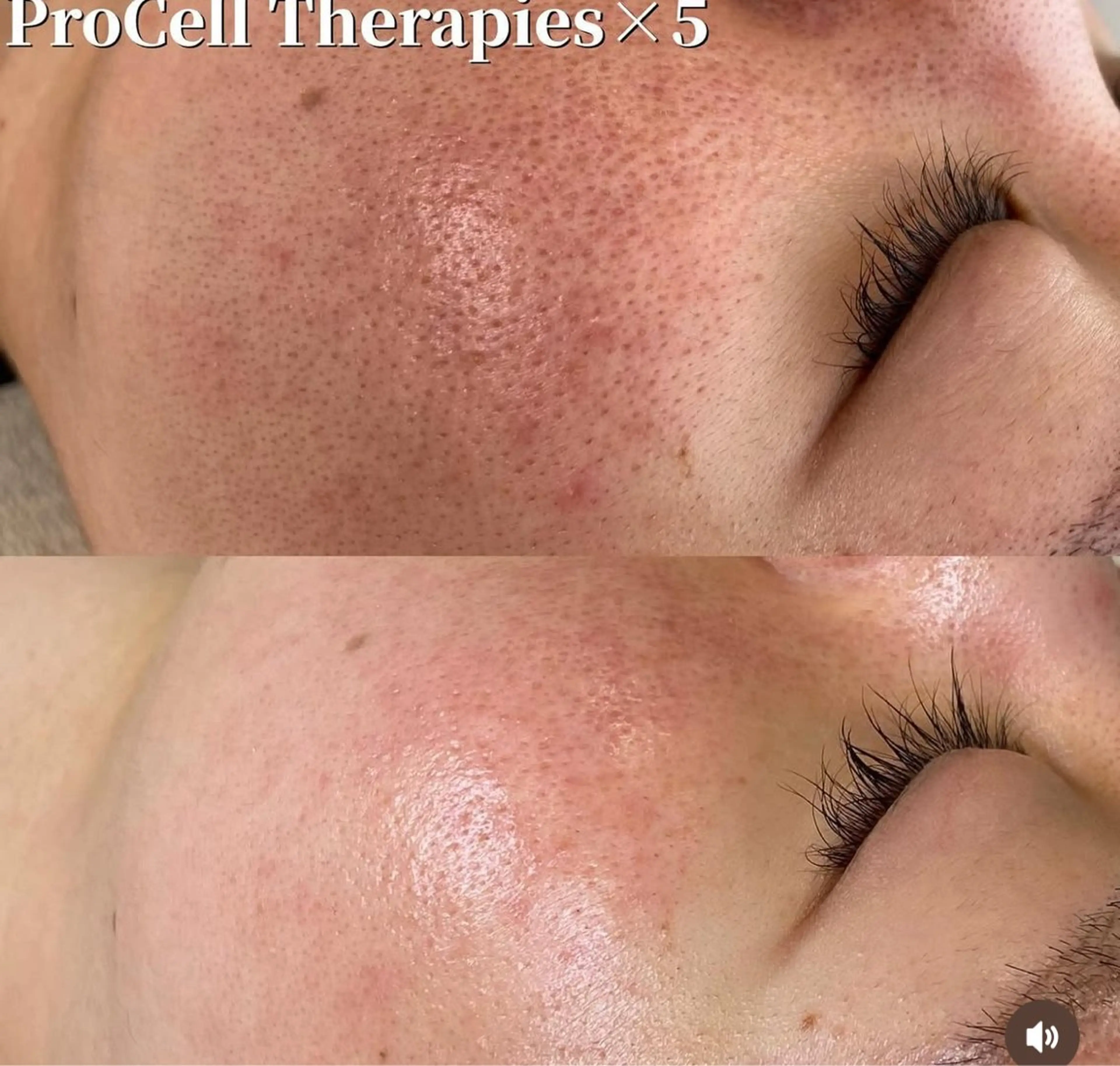 LOUISE. ／肌質・頭皮のエステ・リラクイメージ