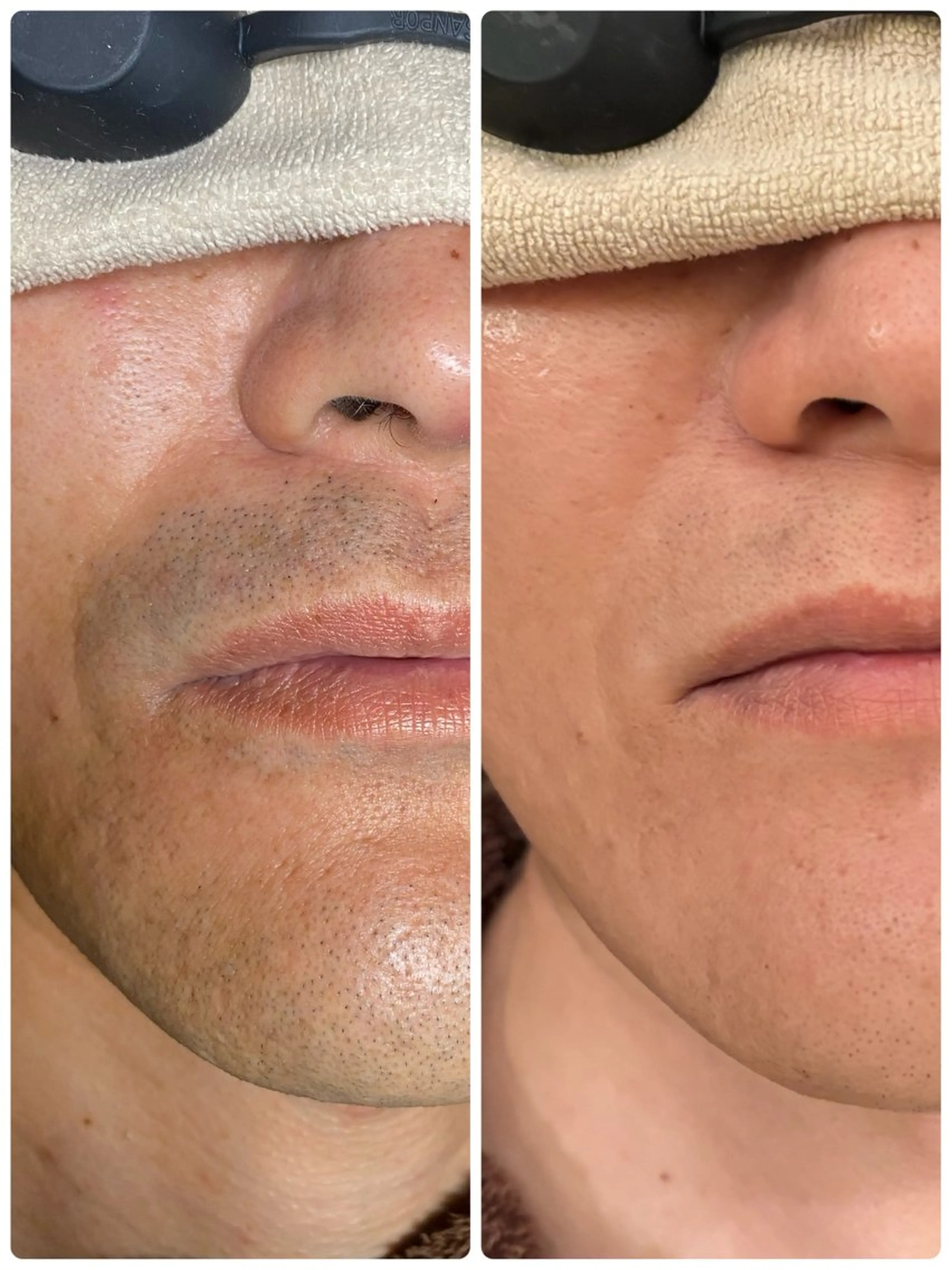 メンズ メンズガーデン 今池の眉毛・アイブロウイメージ