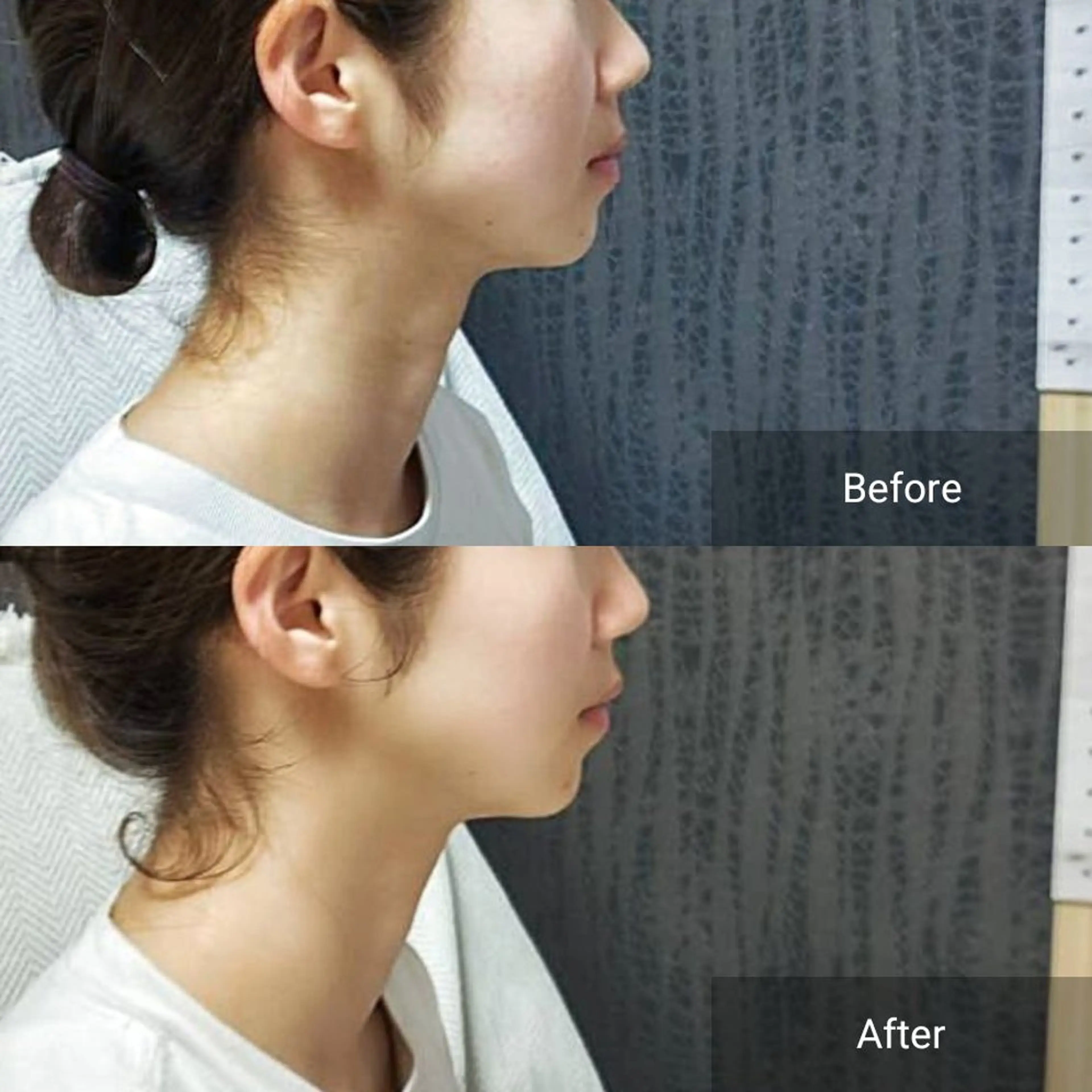 エステ nail RiRi アトレナチュラのエステ・リラクイメージ