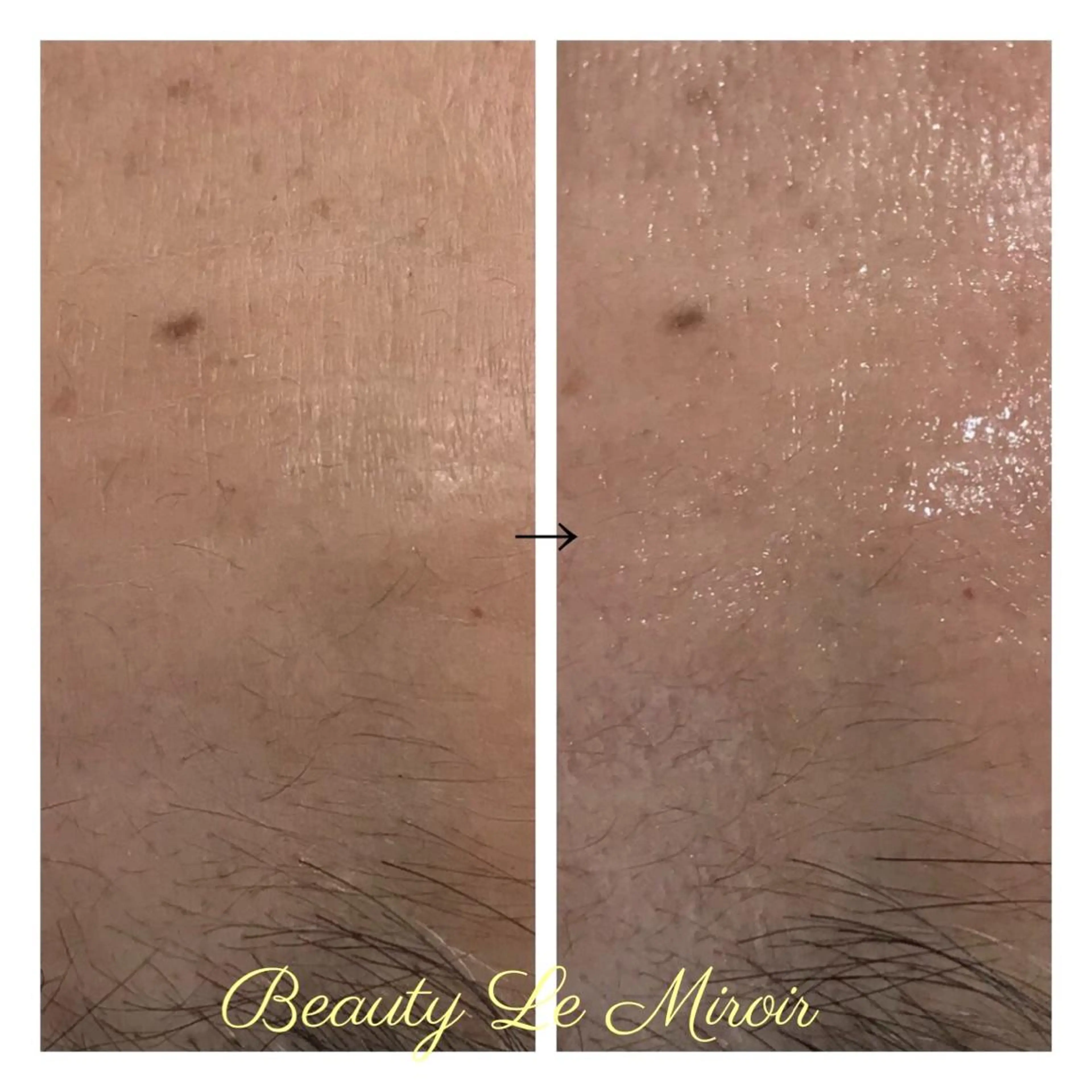 ビューティー ミロワールのエステ・リラクイメージ