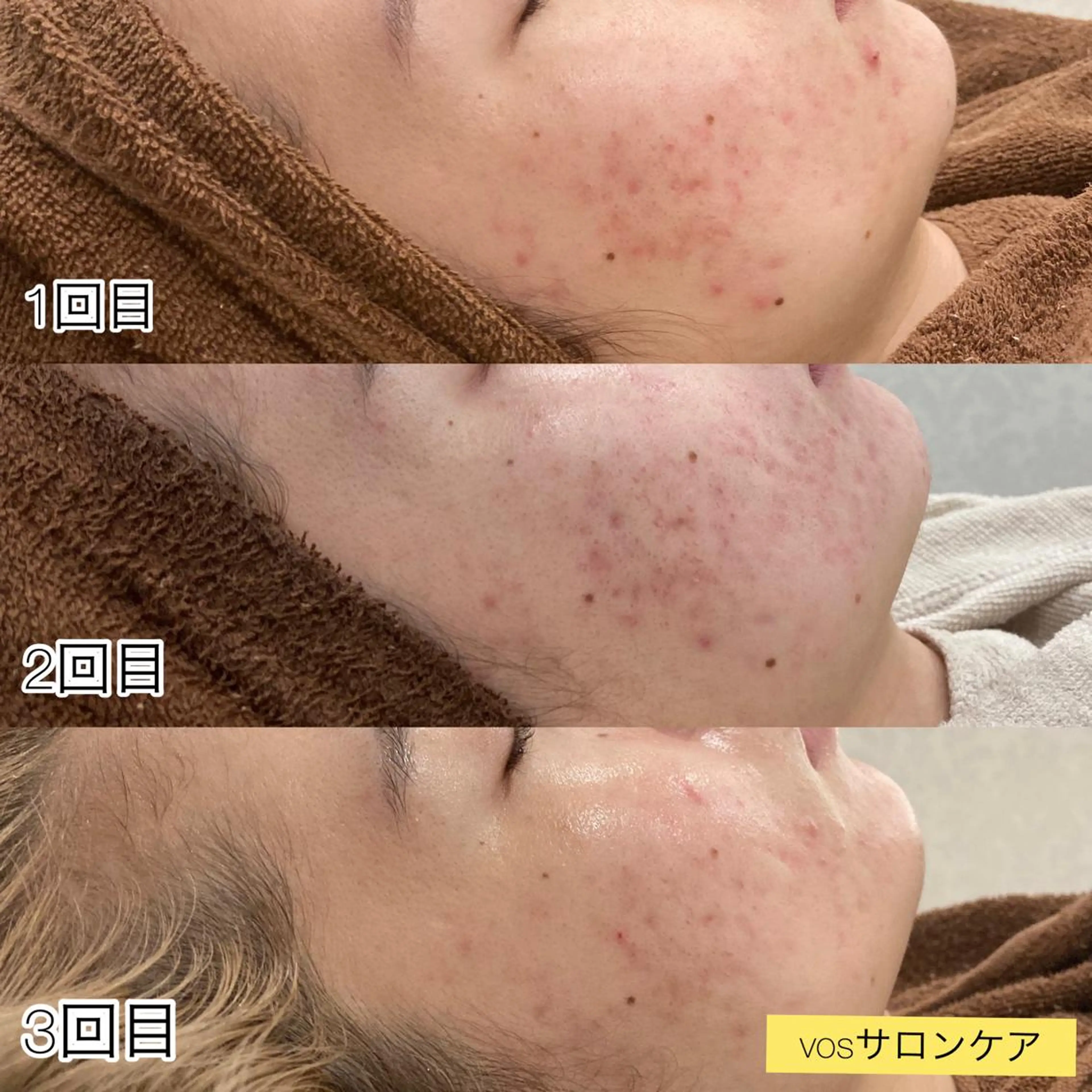 laluna saki...のその他イメージ