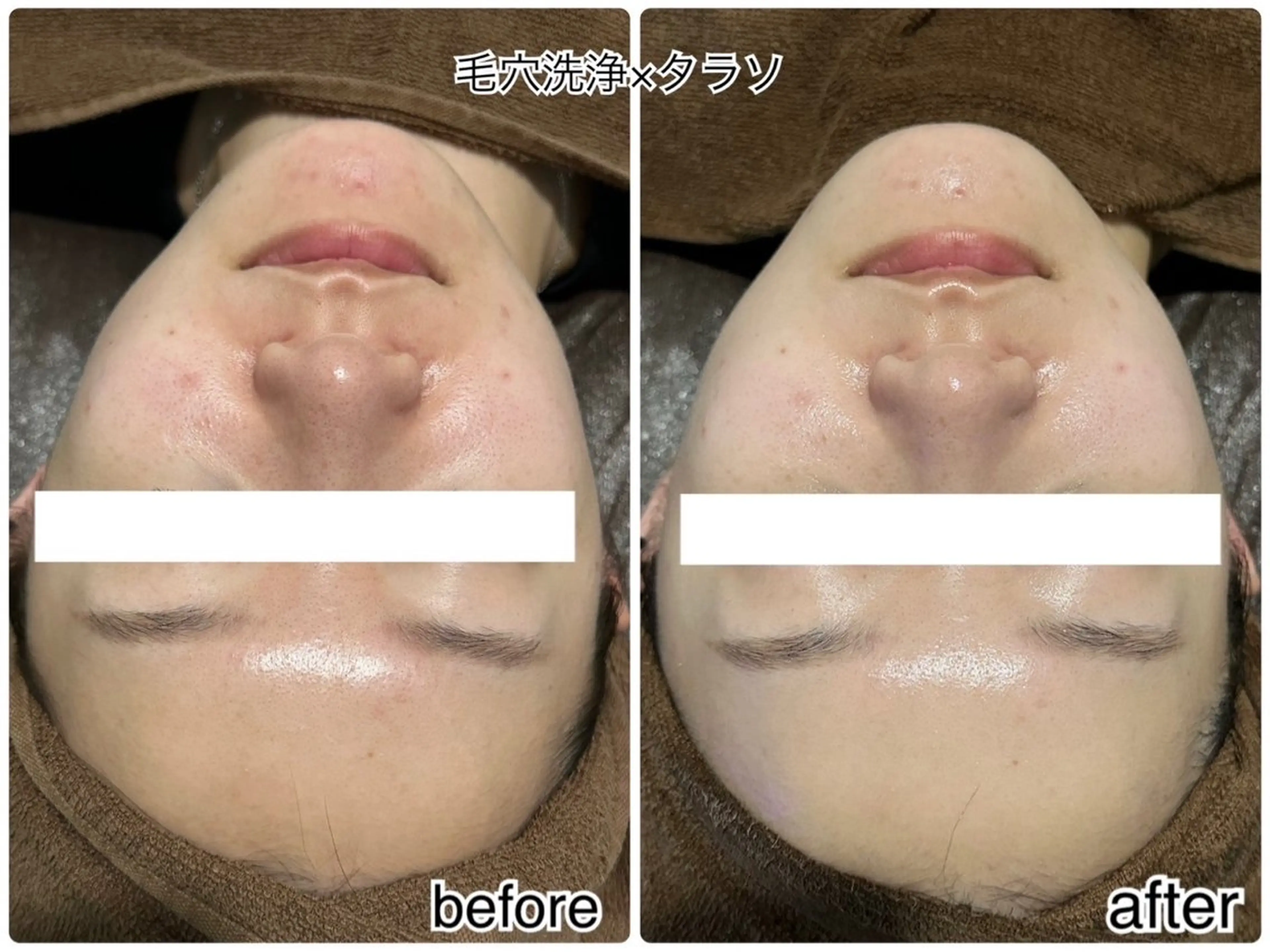 ENCHANT Kaede/肌質改善のその他イメージ