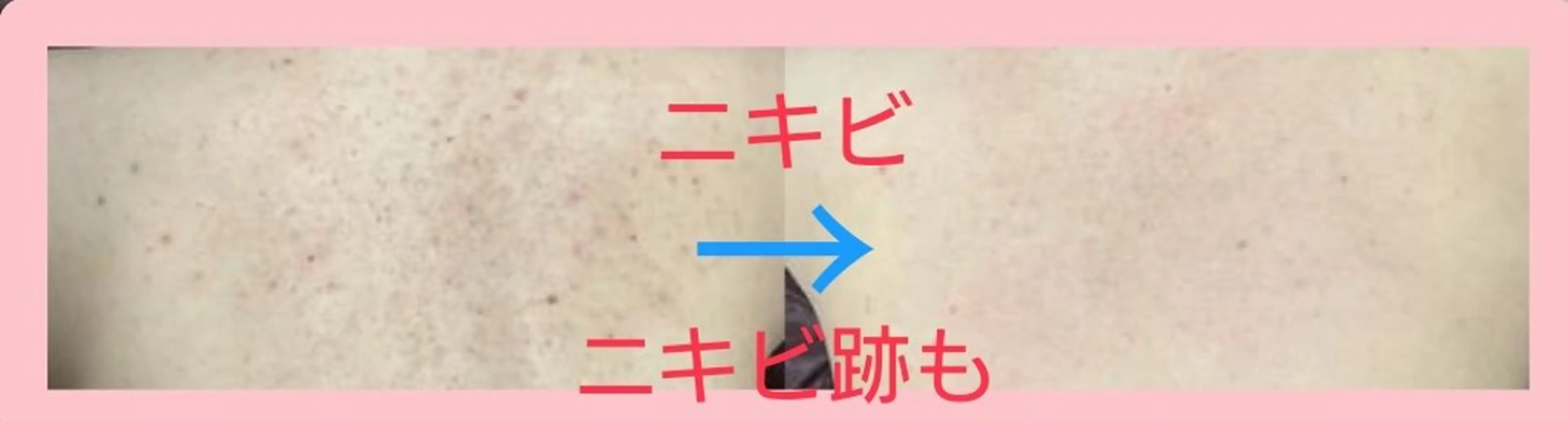 エステ ハーブピーリング 専門店Kikkaのエステ・リラクイメージ