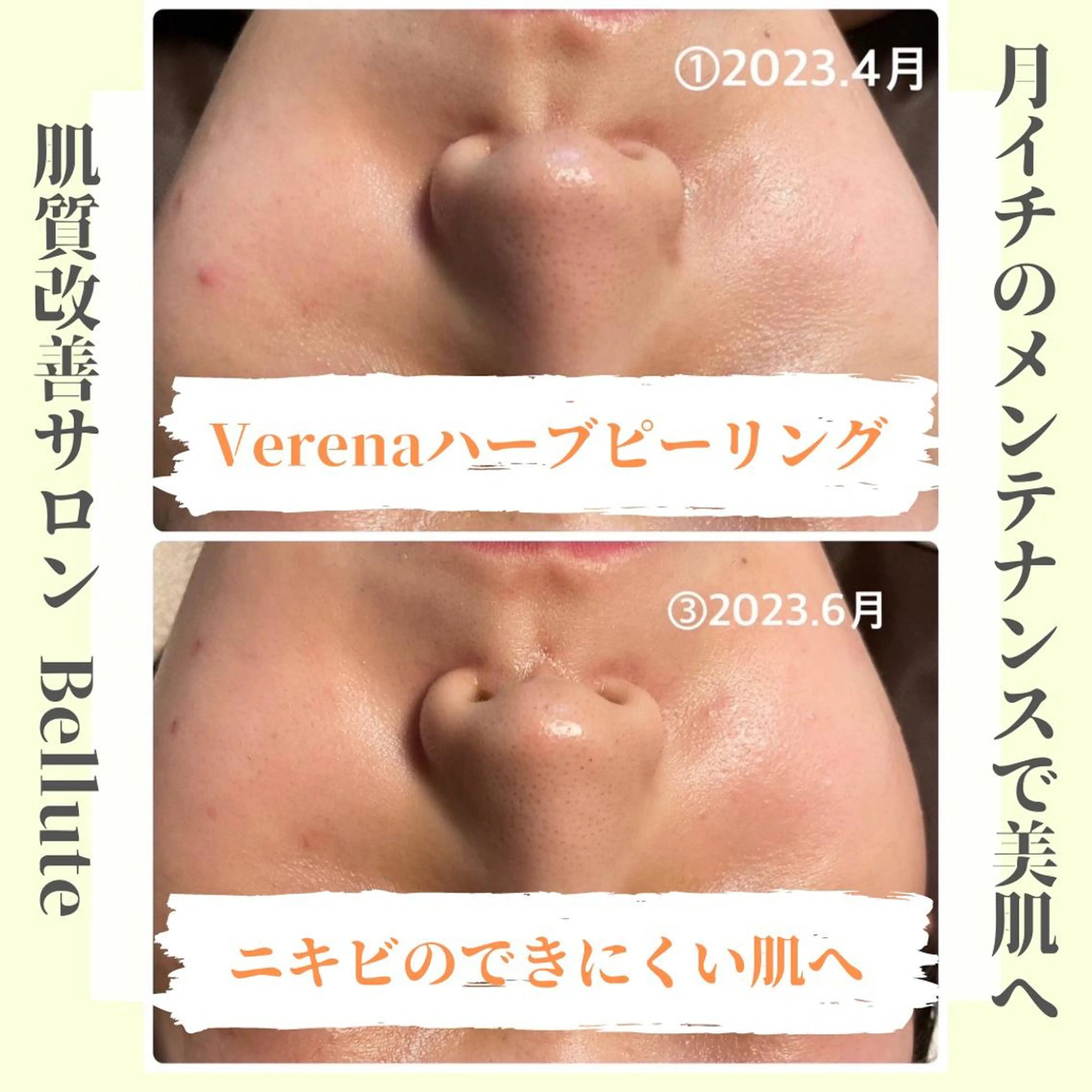 ピーリング専門店 Belluteのエステ・リラクイメージ