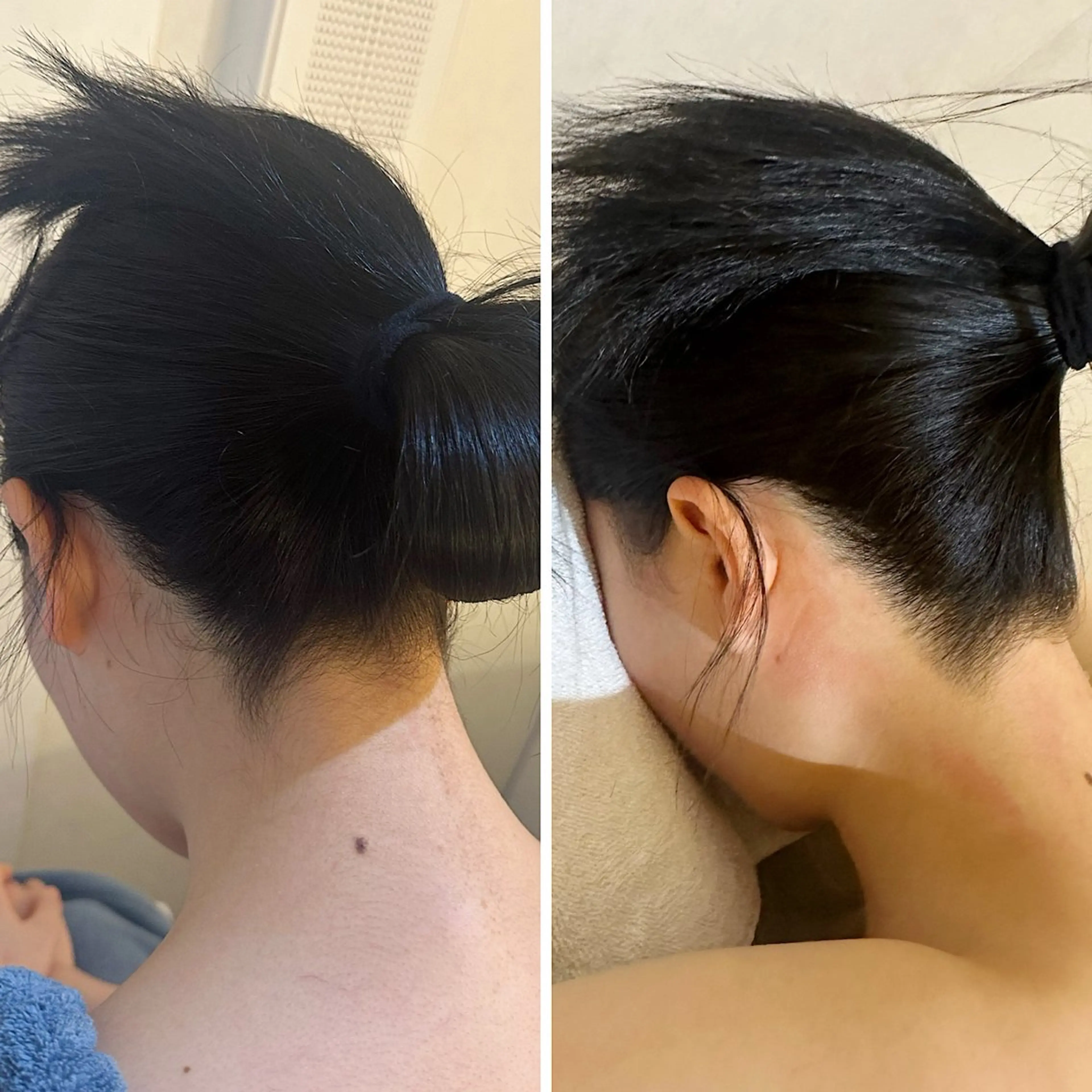 脱毛 うなじ脱毛/美肌脱毛 LABELのエステ・リラクイメージ