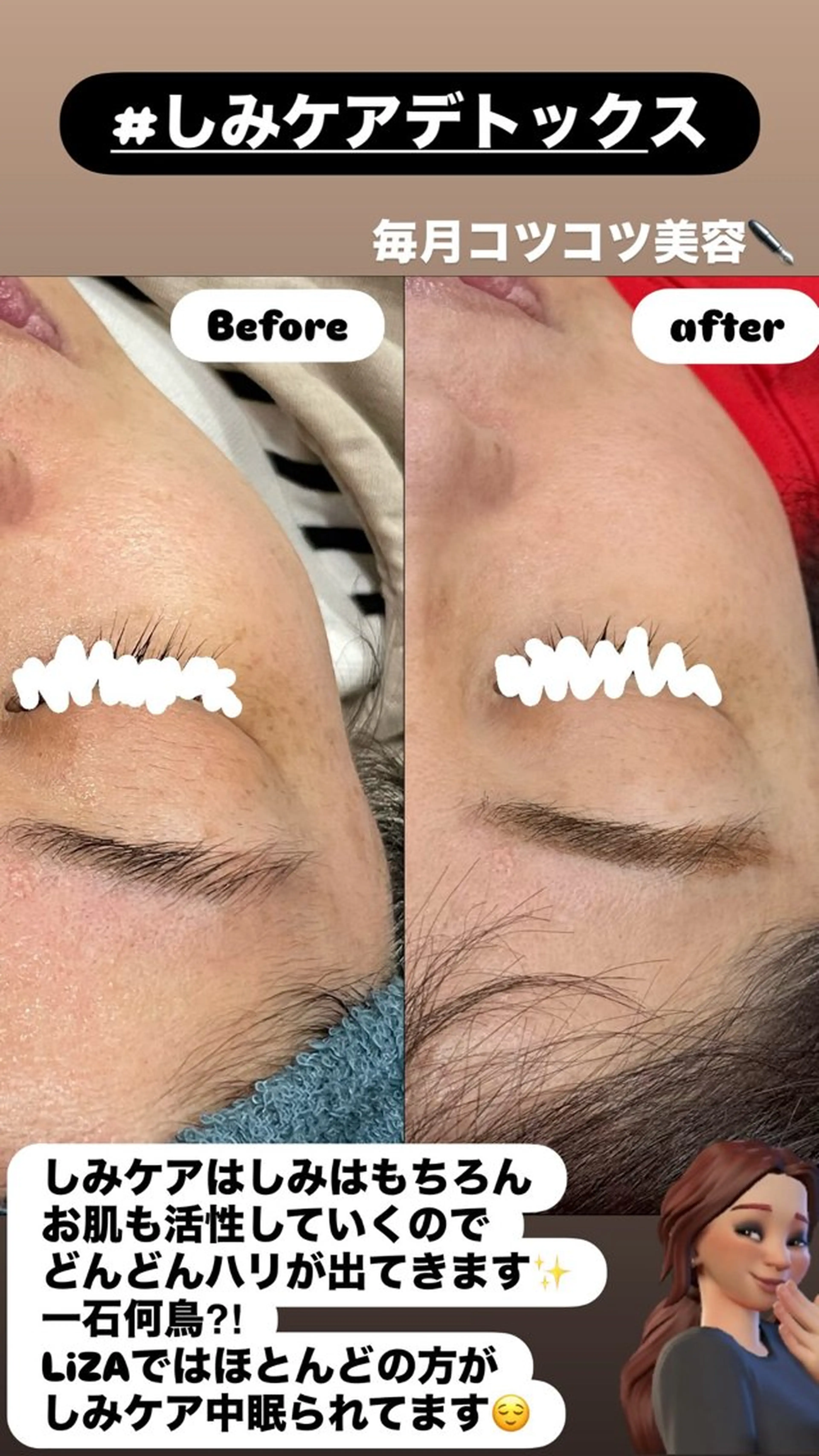 エステ LiZA エステティックサロンのエステ・リラクイメージ