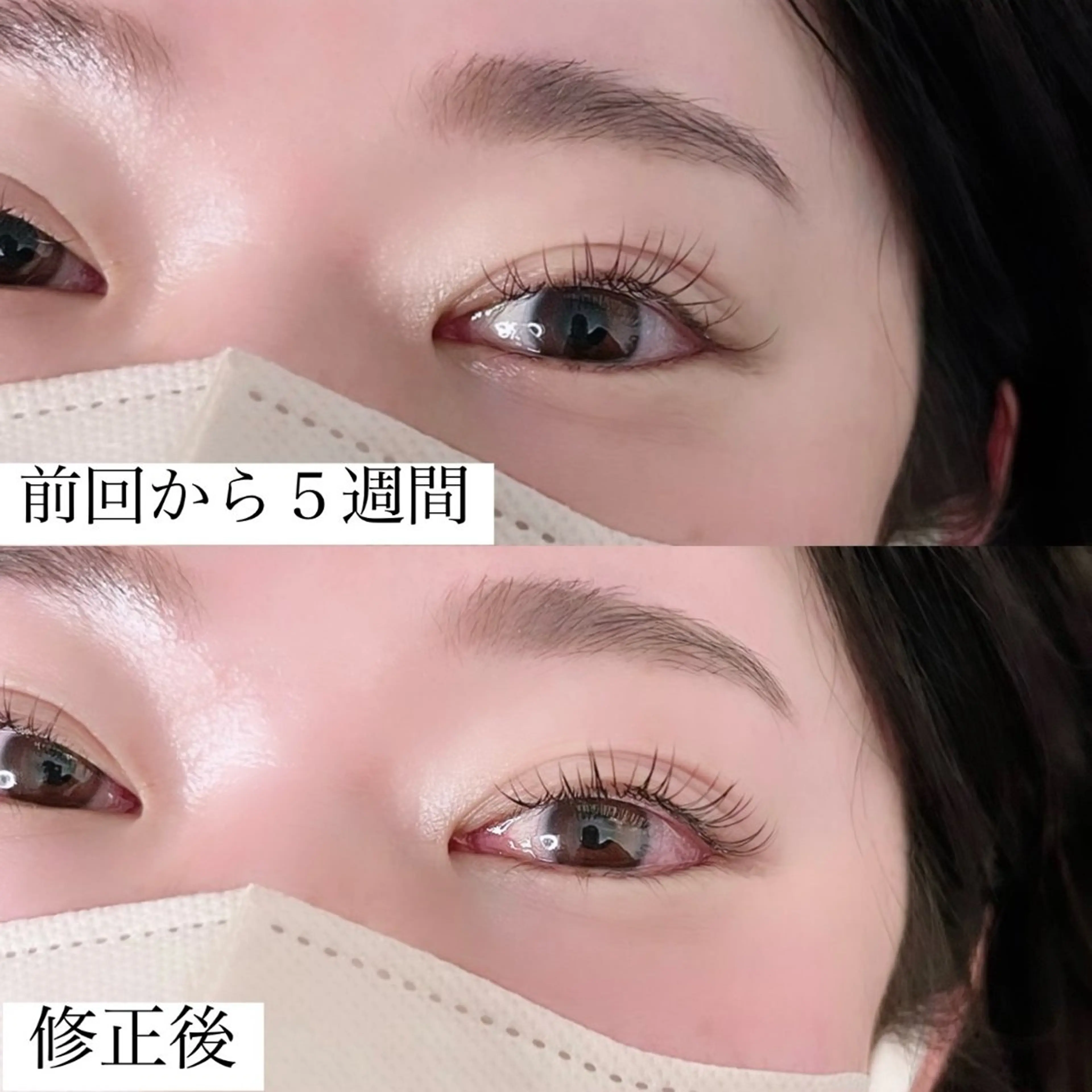 フラットラッシュ100本の写真