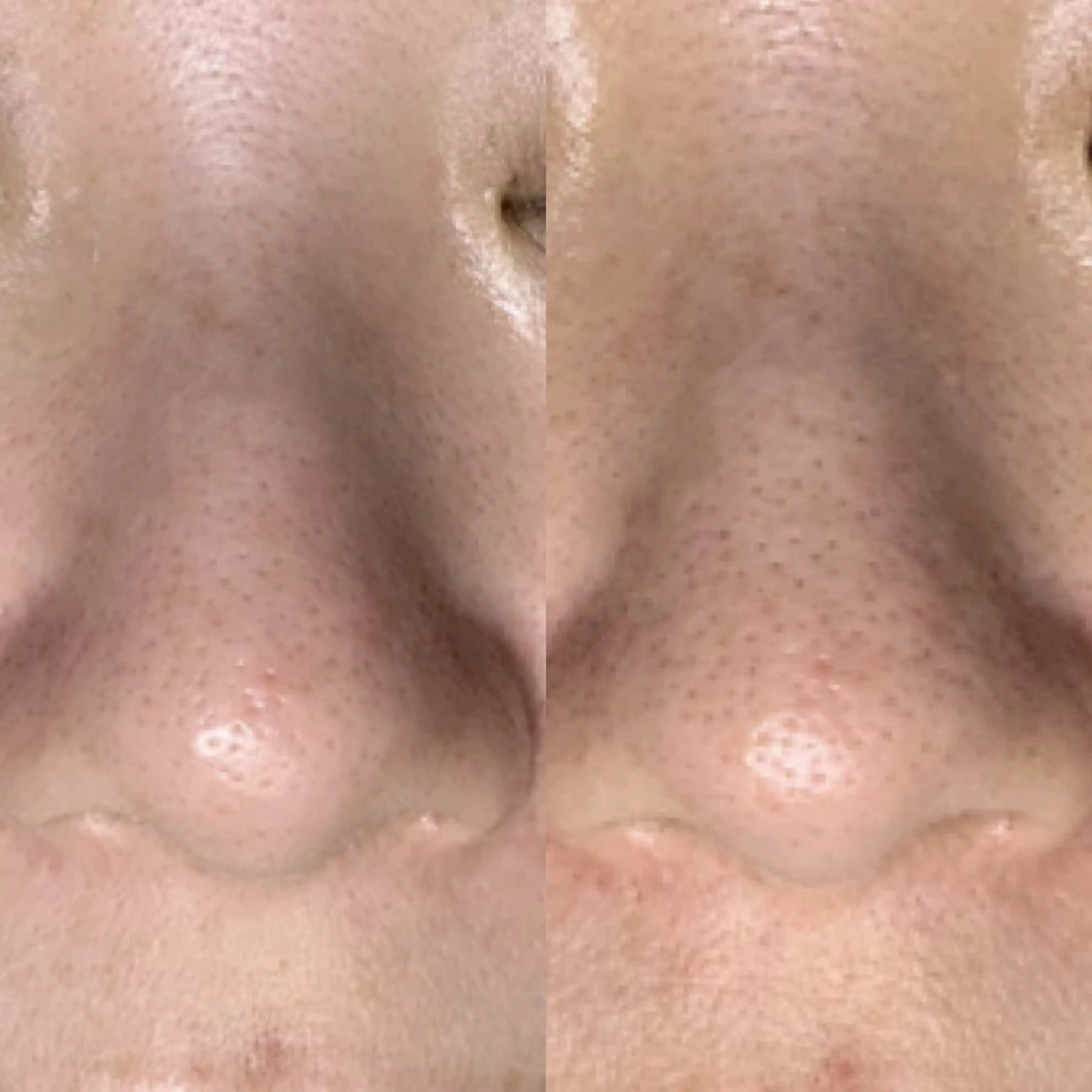 ROUN' 齋藤のエステ・リラクイメージ