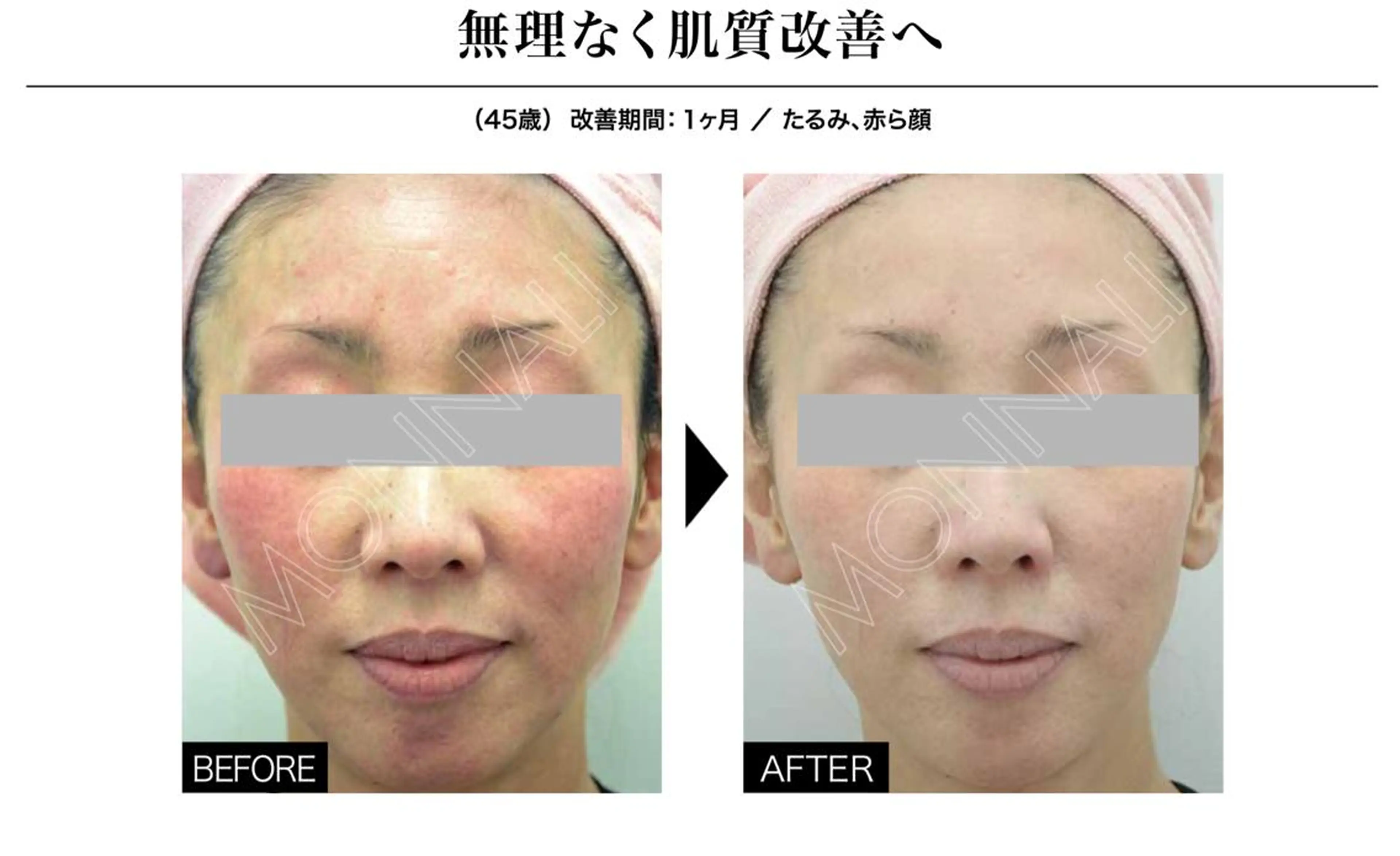 井上 みあのエステ・リラクイメージ