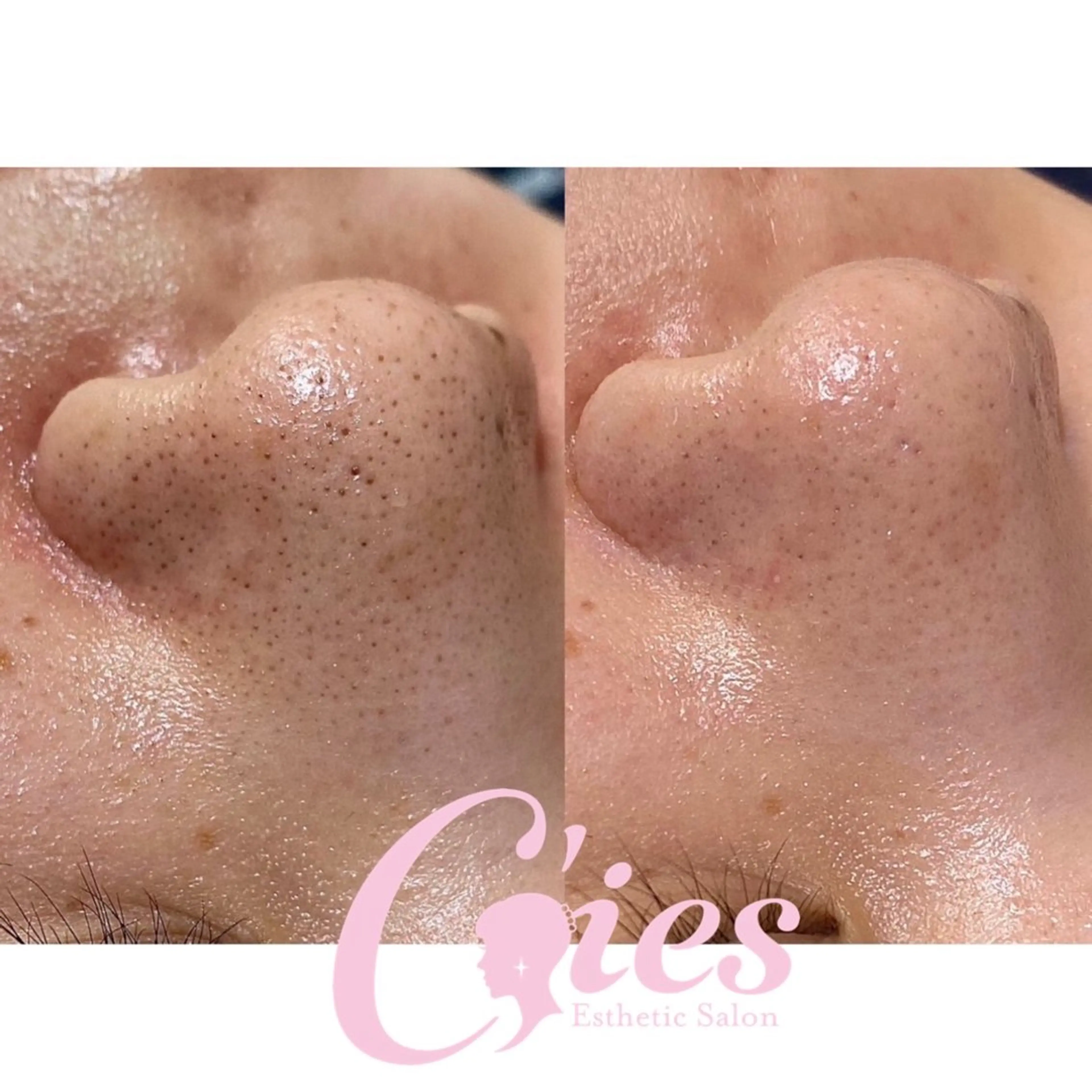 エステ C'ies Esthetic Salon所属・CHIAKI ♪のエステ・リラクイメージ