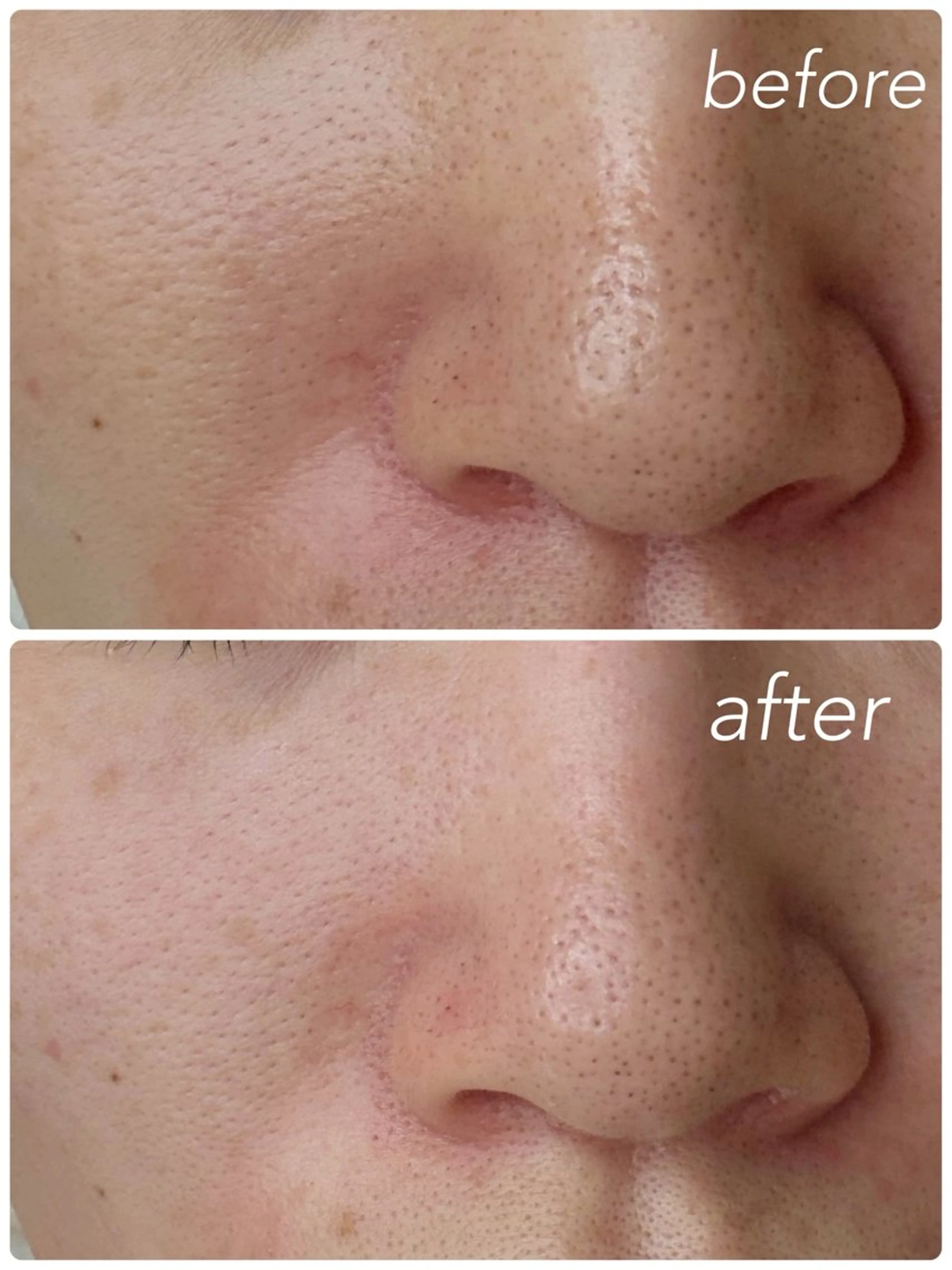 エステ リラク 肌管理🌿毛穴改善 POLA堺東のエステ・リラクイメージ