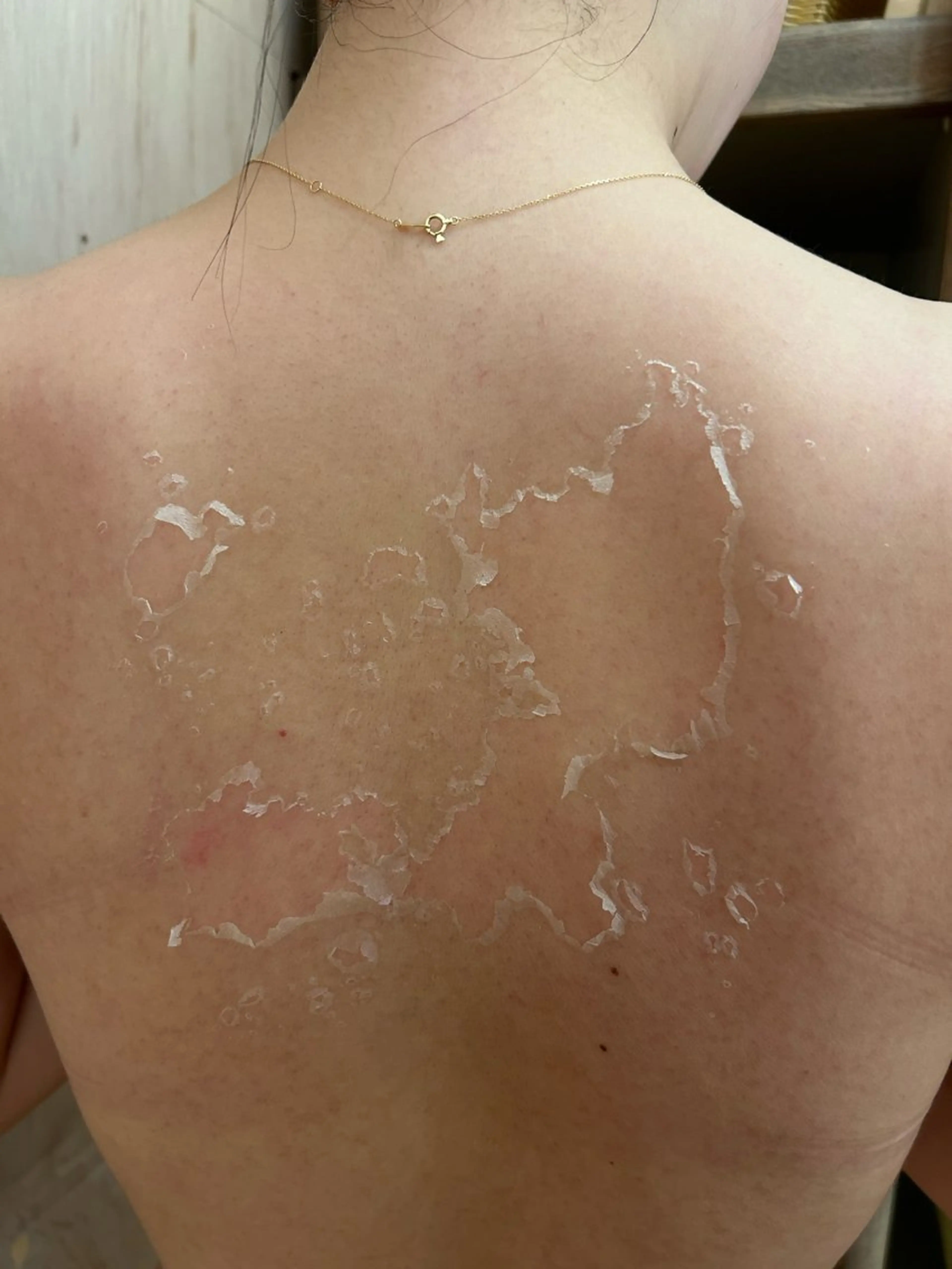 エステ clé skin 🌿ハーブピーリングのエステ・リラクイメージ