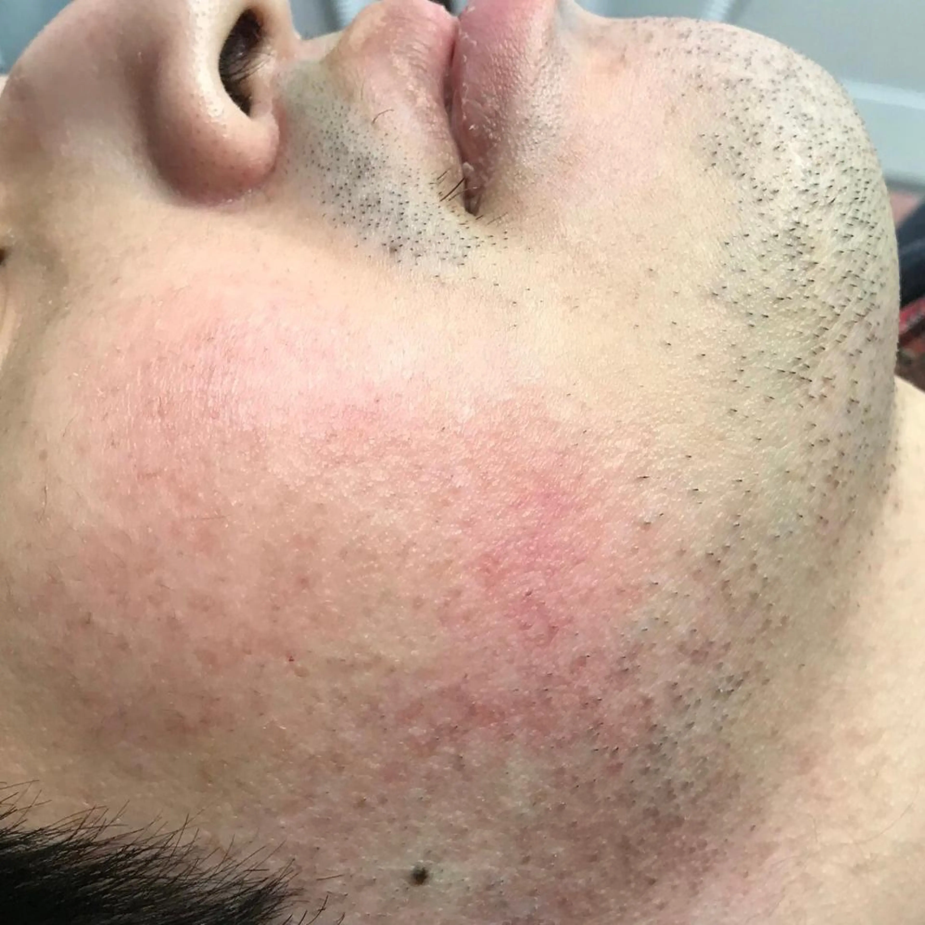 Lilyboo 星のエステ・リラクイメージ