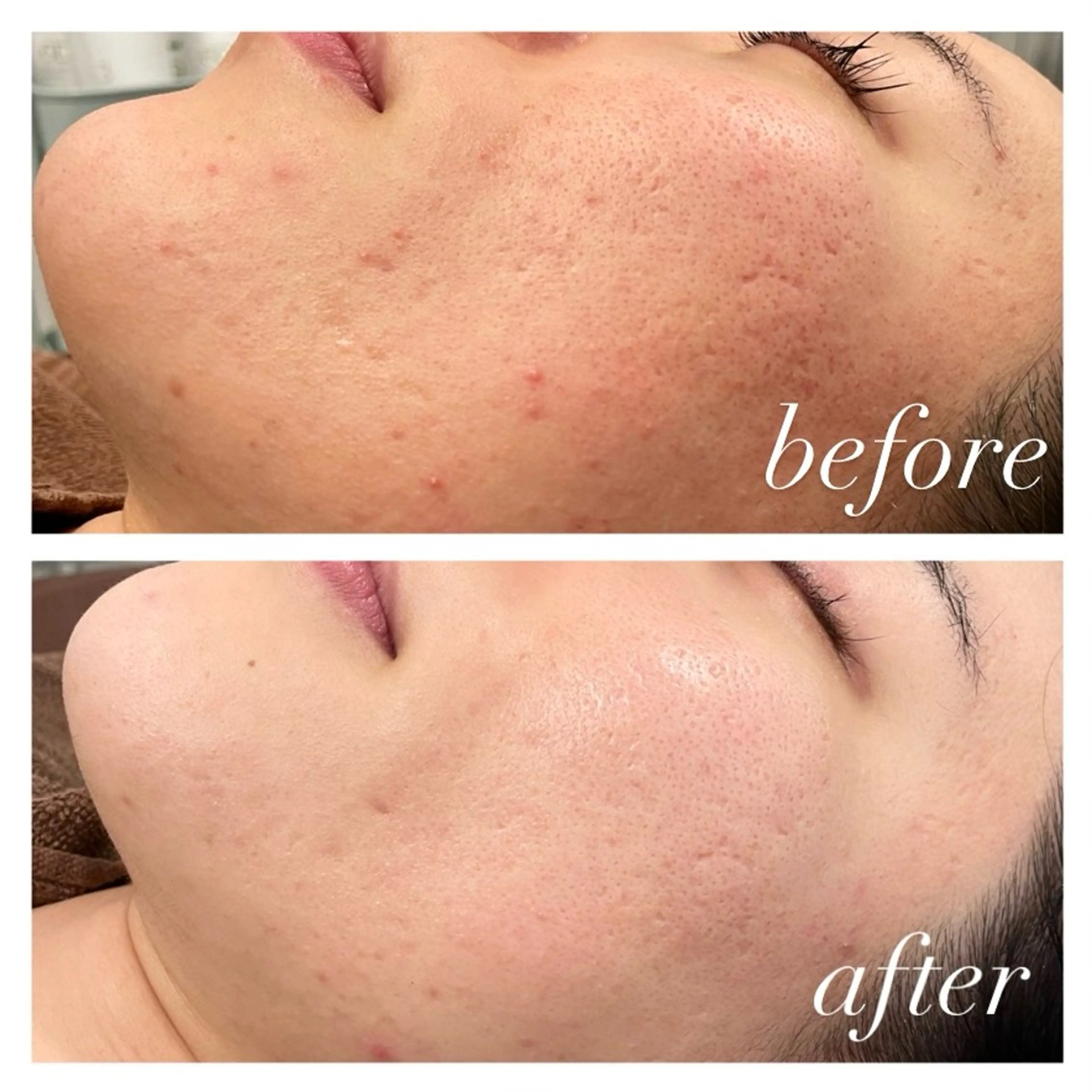 エステ 🦋美肌サロン. maho🦋のエステ・リラクイメージ